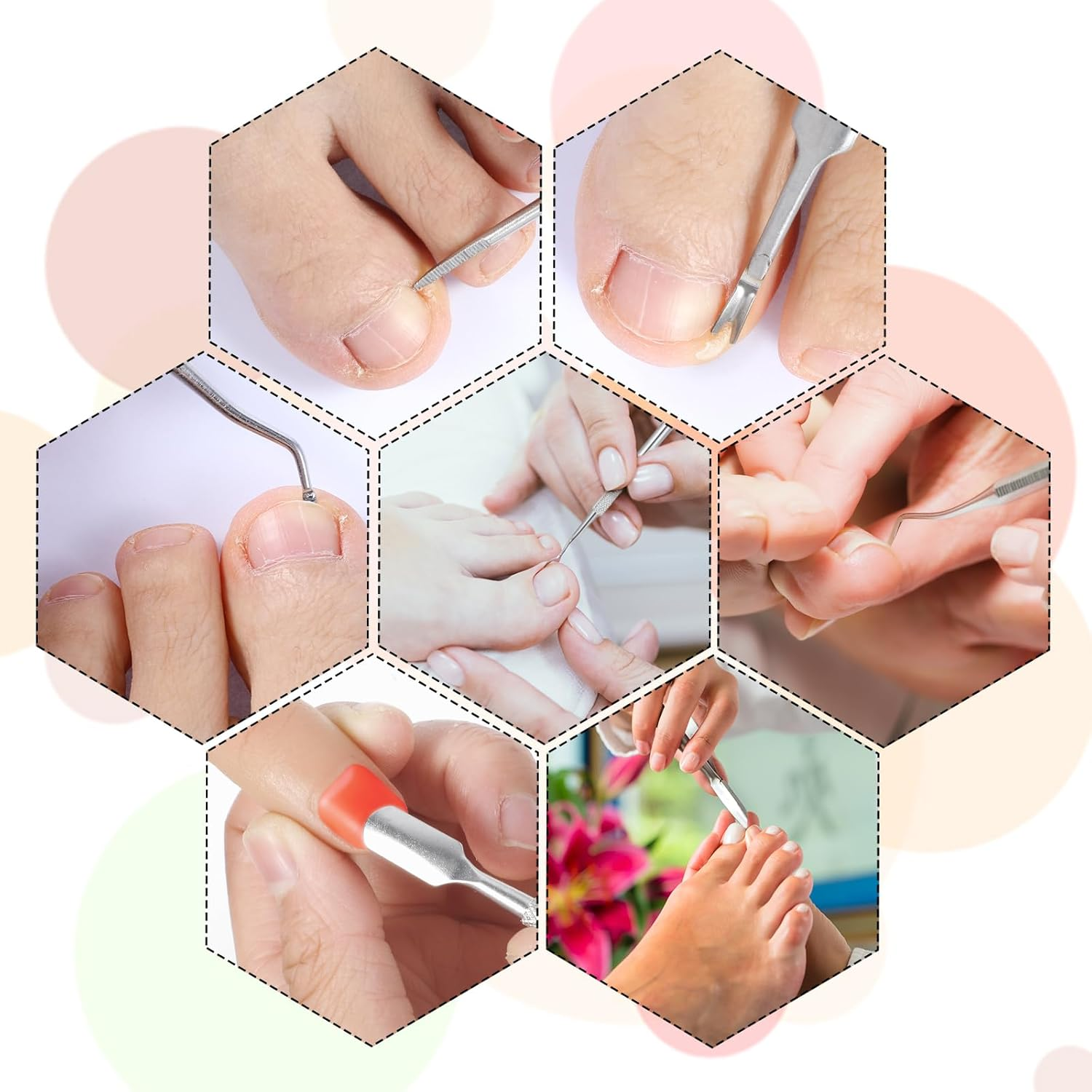 7Pcs Ingrown Toenail Pedicure Tool, Stainless Steel Ingrown Toenail File and Ingrown Toenail Lifters, Ingrown Toenail Removal Kit Professional Nail Treatment Manicure Tools under Nail Cleaner image number 1