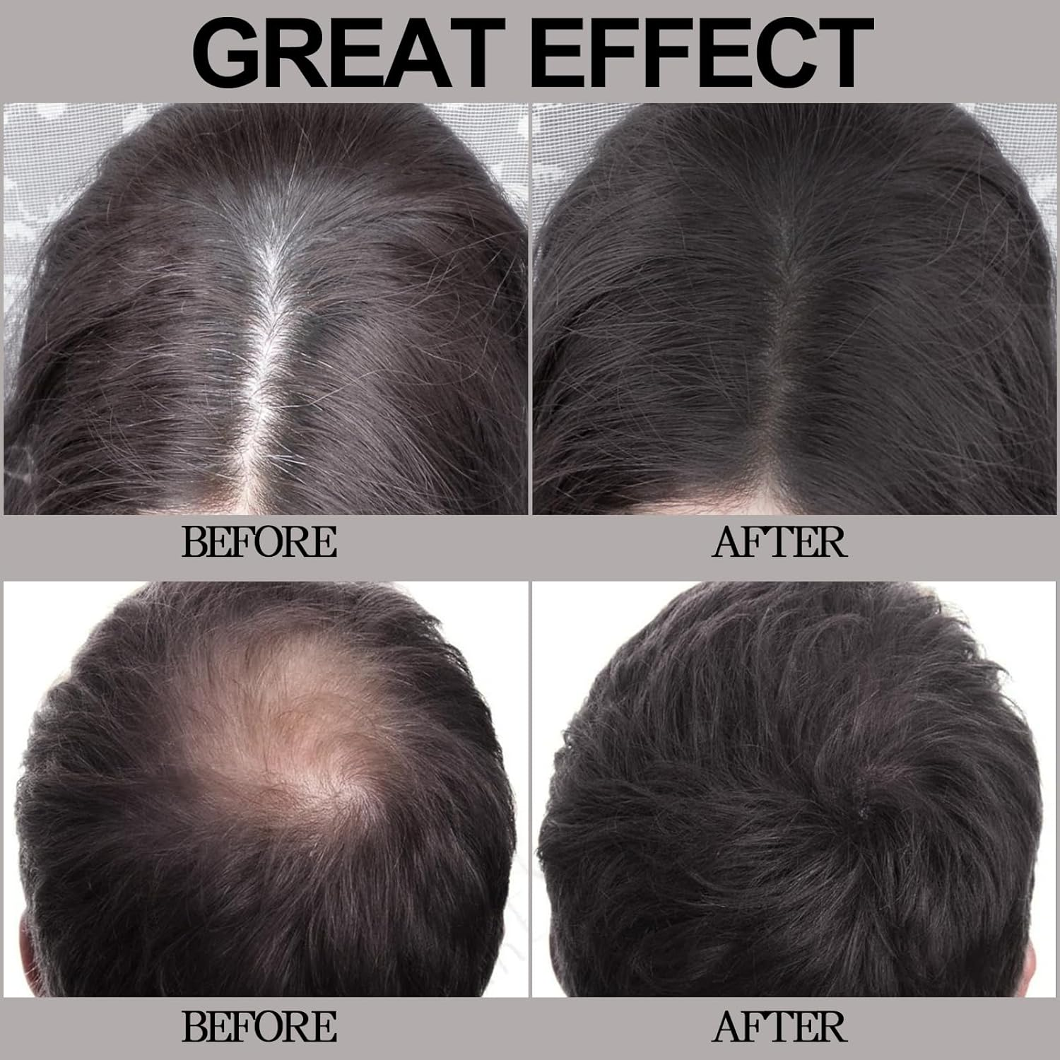 Apooliy Hairline Powder,Hair Shadow for Thinning Hair for Women and Men,Cover Gray Hair Root Touch up Powder,Hair Shading Filler - 03-Grey Brown image number 3