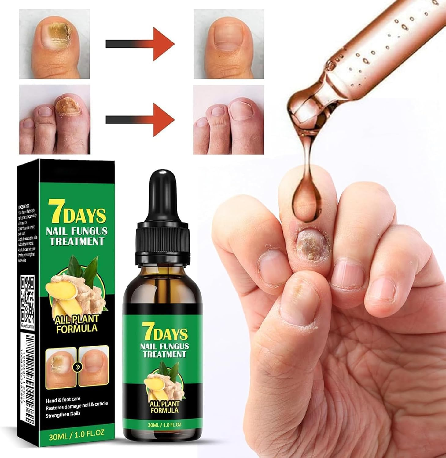 Ginger Nail Support Nail Care,Nail Strengthener for Damaged Nails,7 Days Nail Fungus Treatment,Toenail Cuticle Care Oil for Nails image number 6