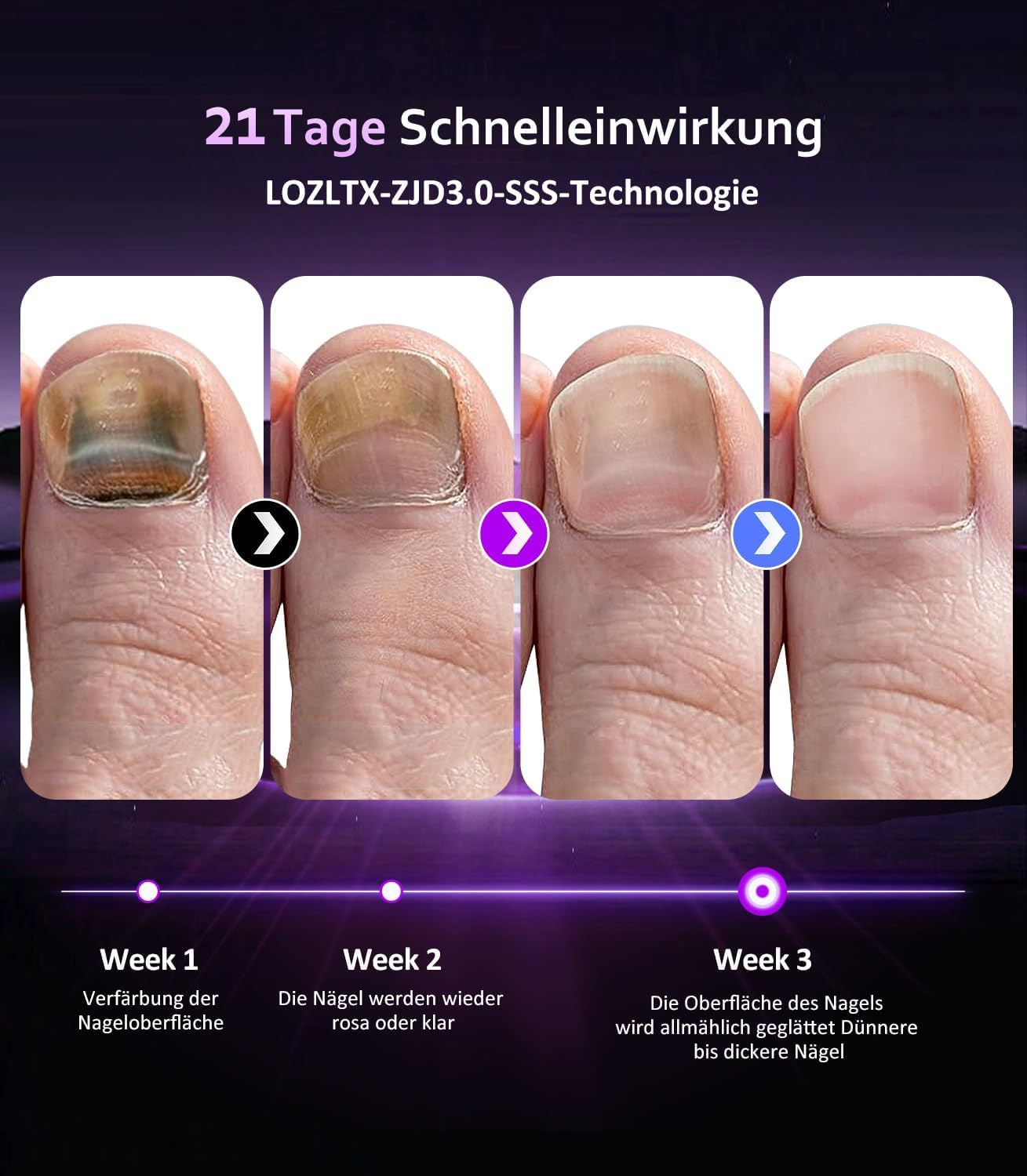 LOZLTX Nail Fungus Laser Device, Upgrade 3 X 470 Nm Blue & 1 X 905 Nm Infrared Light, Nail Fungus Laser 【21 Days Fast Acting】Nail Fungus Test Winner image number 4