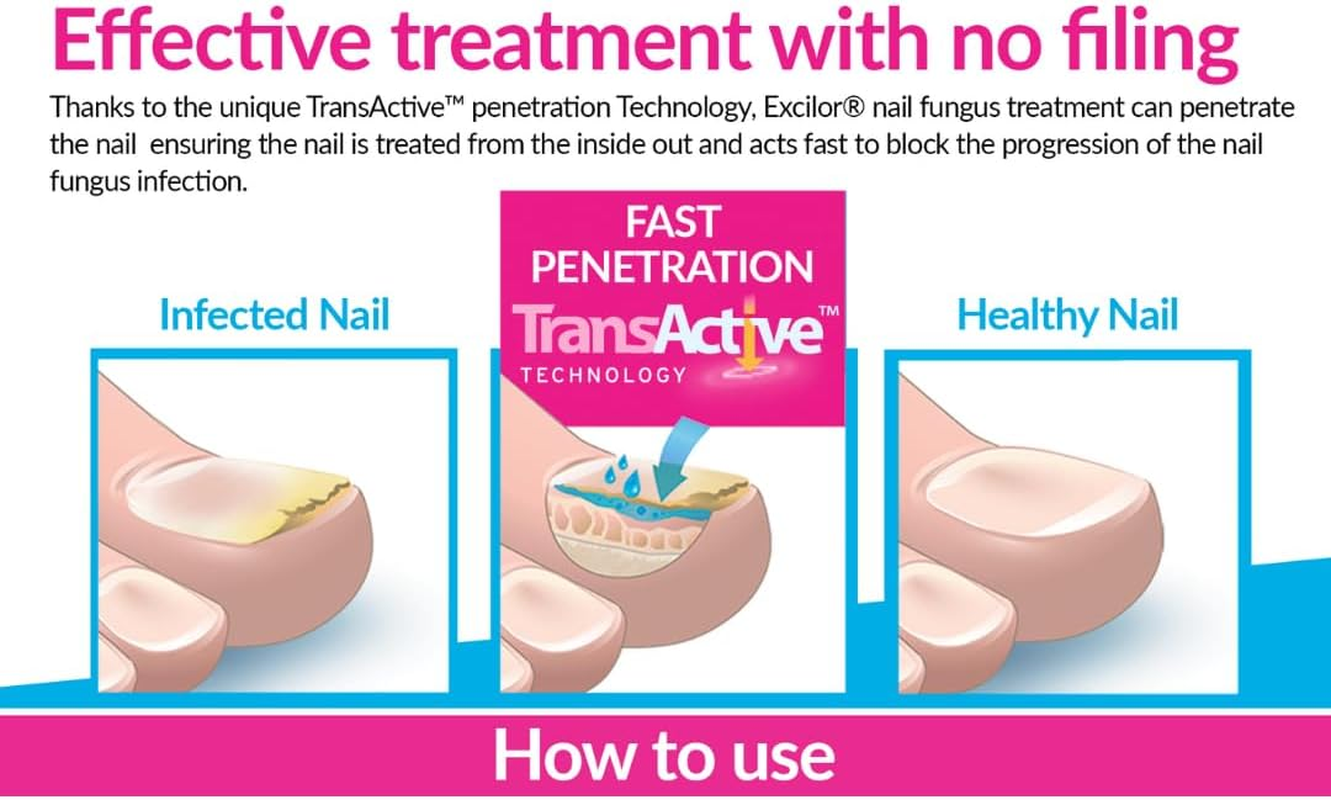 EXCILOR - Effective Nail Fungus Treatment - Solution - Returns Infected Nails to Healthy & Beautiful - Fast Penetration - Easy Brush Application - No Filing - Clinically Proven - 3.3Ml image number 5