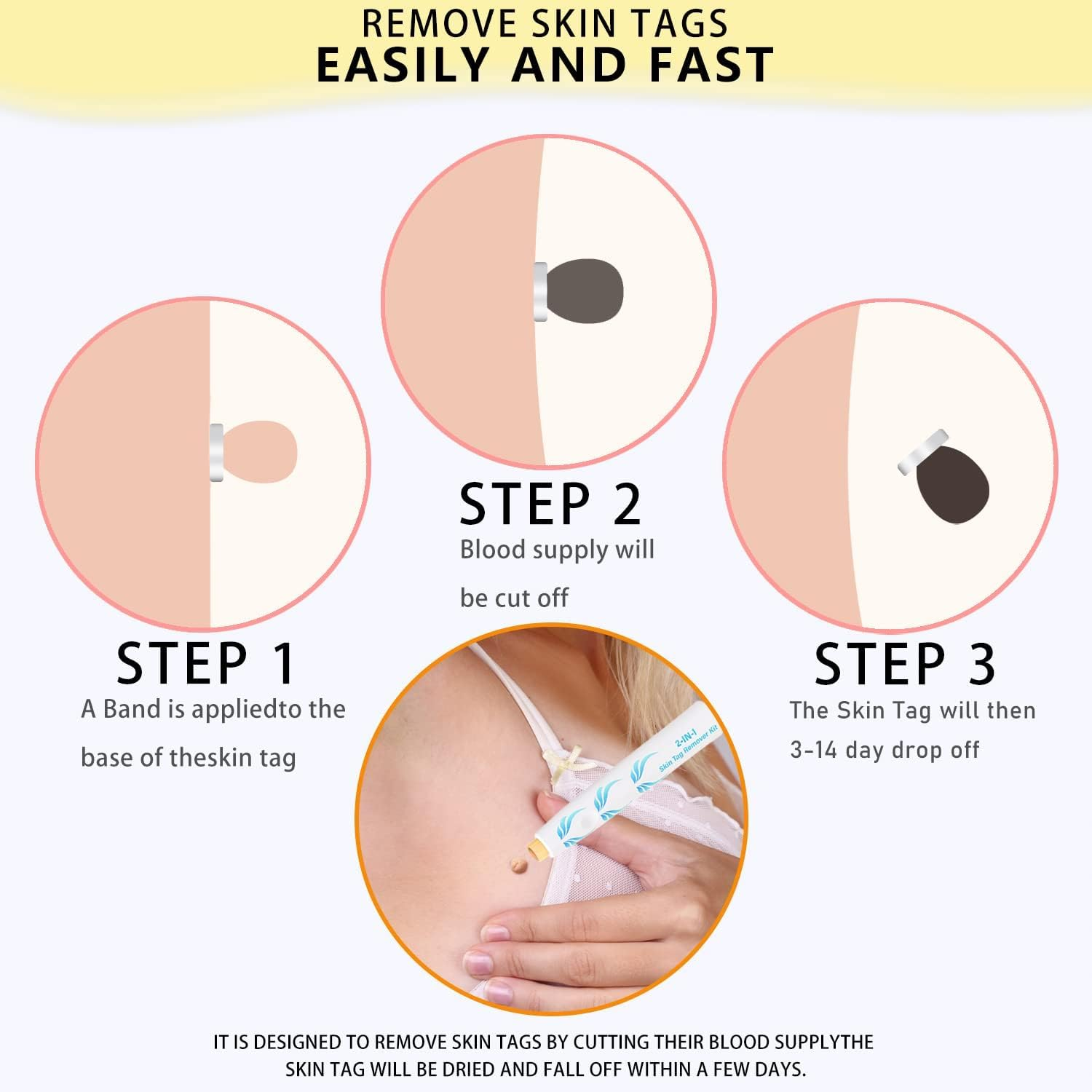 2-IN-1 Skin Tag Tool for 2-8 Mm Size Skin Tags Painless Skin Tag Removal Kit with 36 Repair Patches and 10 Cleansing Wipes Easy to Use for Most Body Parts image number 5