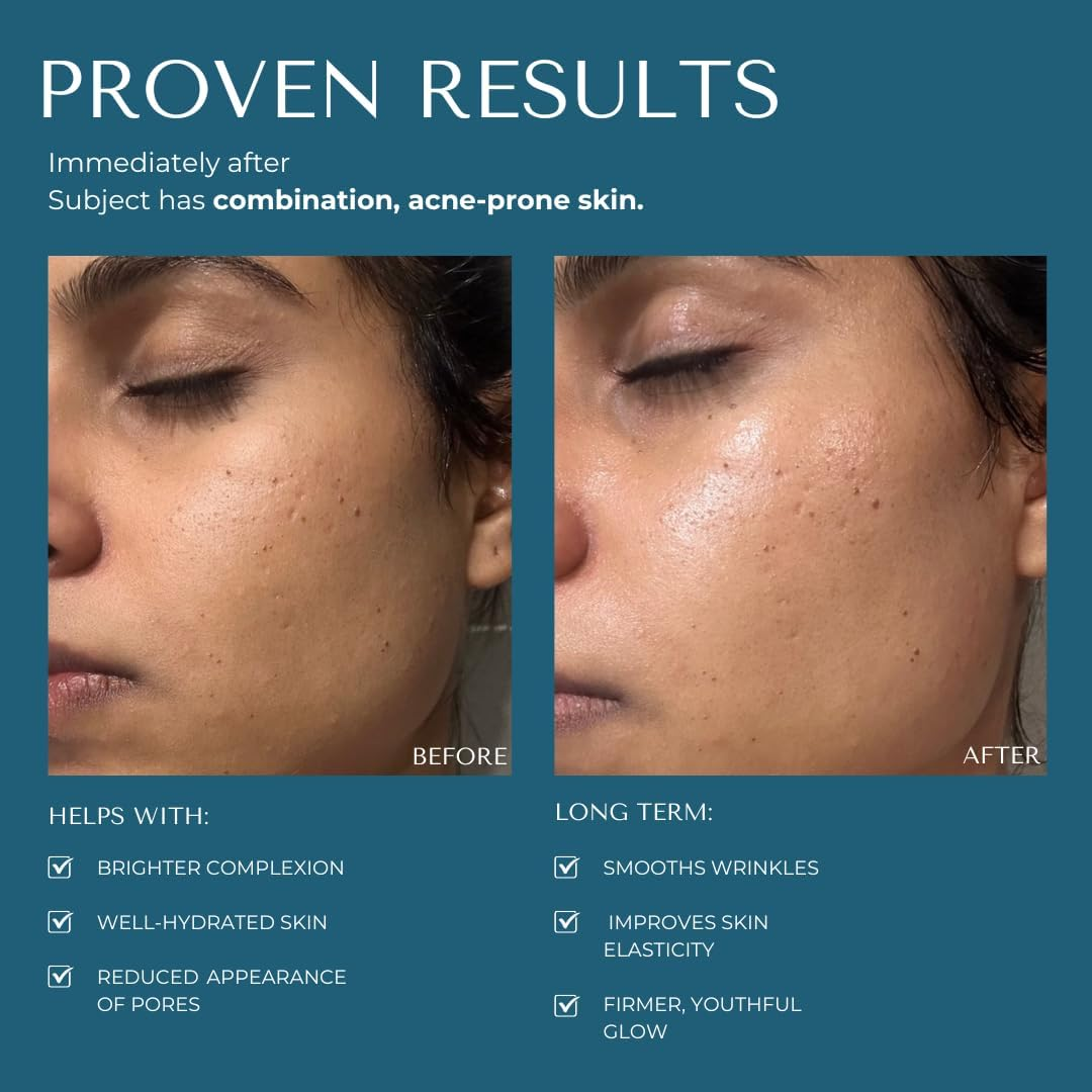 Kaashi Brightening Facial Serum, Vitamin C + Hyaluronic Acid + Ceramides, Anti-Aging, Hydrating, for Dry, Mature & Sensitive Skin image number 3