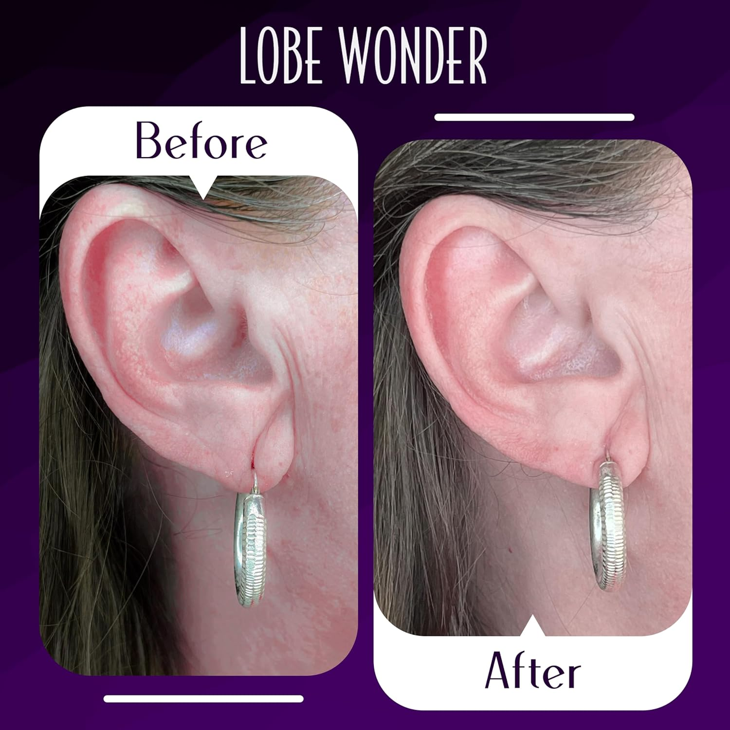 Lobe Wonder - the ORIGINAL Ear Lobe Support Patch for Pierced Ears - Eliminates the Look of Torn or Stretched Piercings - Protects Healthy Ear Lobes from Tearing - 60 Patches - Clear & Latex-Free image number 4