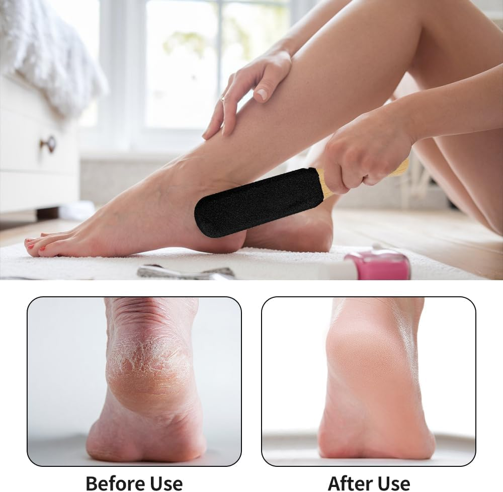Foot Scrubber for Dead Skin Foot Pumice Stone for Feet Foot Scrubber Callus Remover for Feet Foot File Pedicure Tools Feet Scraper Heel Scraper for Feet Foot Scrub Foot Files Callus Remover Pumice Stone 2Pcs