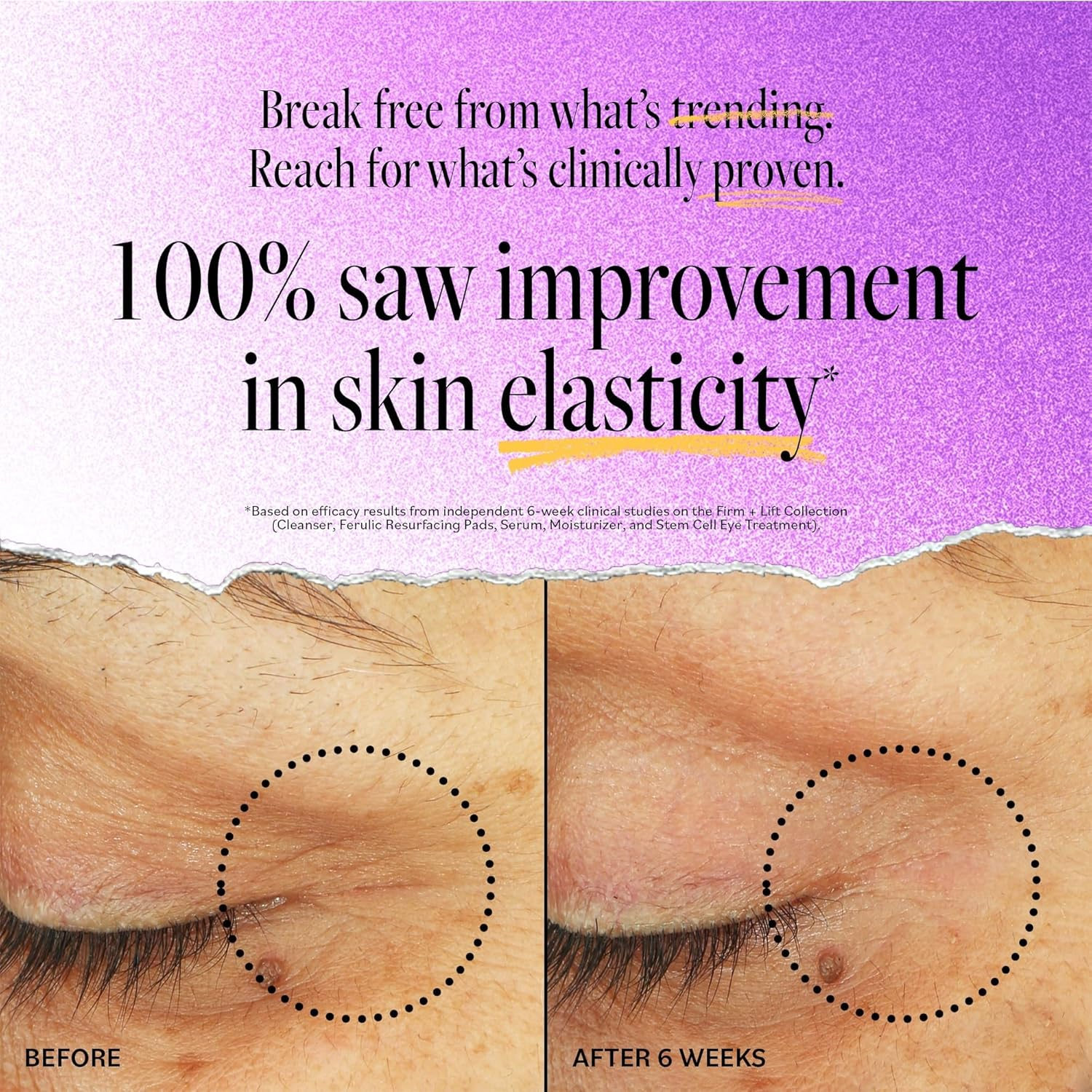 Stem Cell Eye Lifting Treatment image number 4