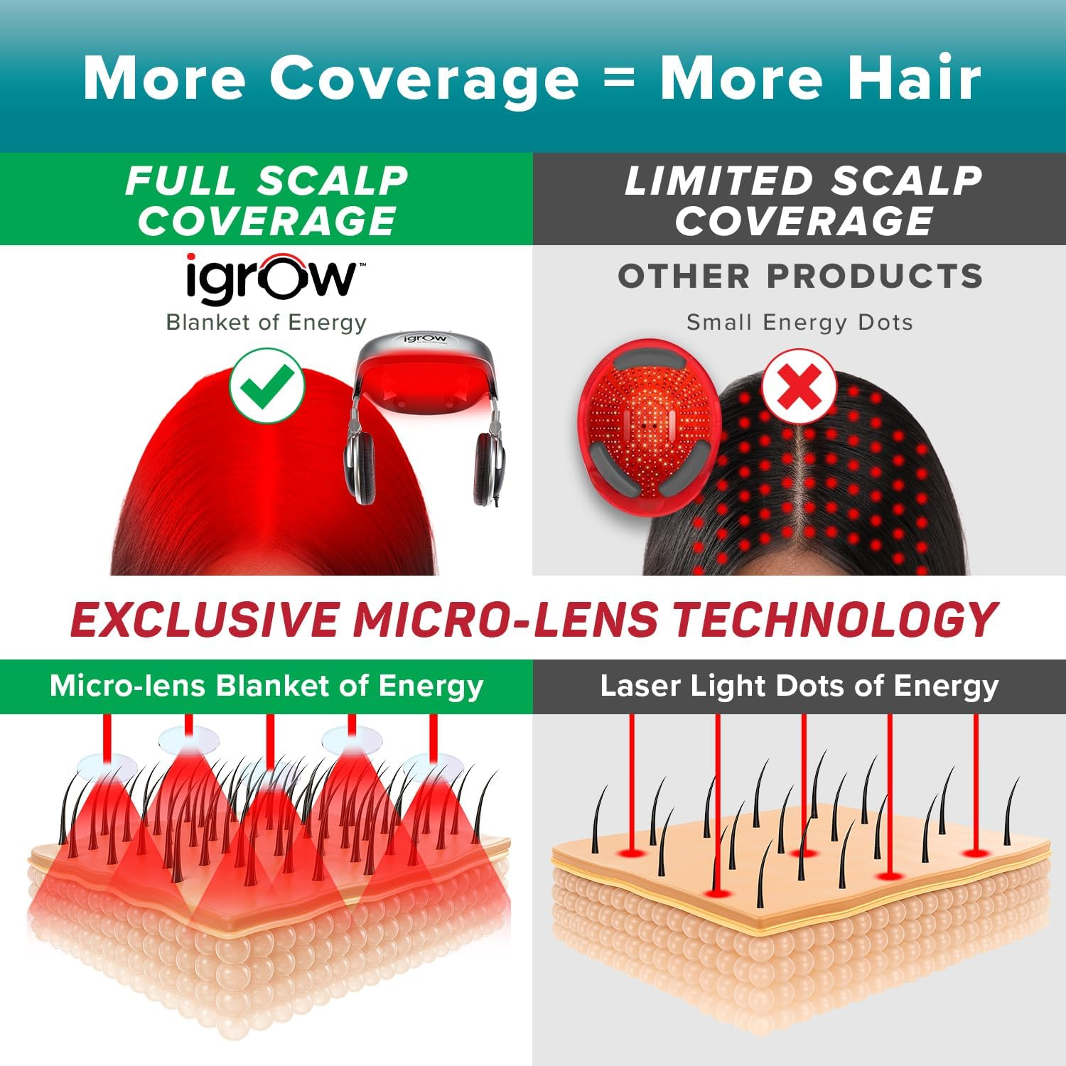 Igrow Laser Hair Growth Helmet: Restoration & Regrowth Treatment System for Hair Loss - Natural Thinning, Balding, and Alopecia Solution for Women and Men - Fda Cleared Low Level Laser Device