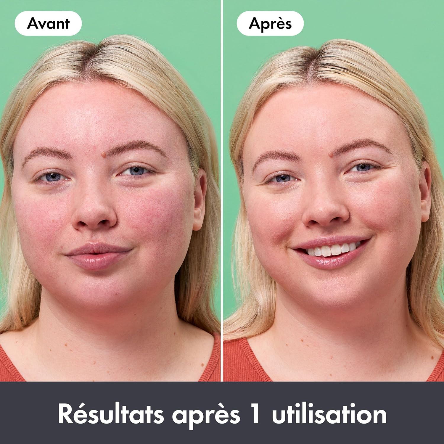 Hero Cosmetics Rescue Balm - Cream for Blemishes & Reduces Redness, Provides Long-Lasting Moisture, for Sensitive Skin, Dermatologically Tested, Great with Pimple Patches, 15 Ml image number 4