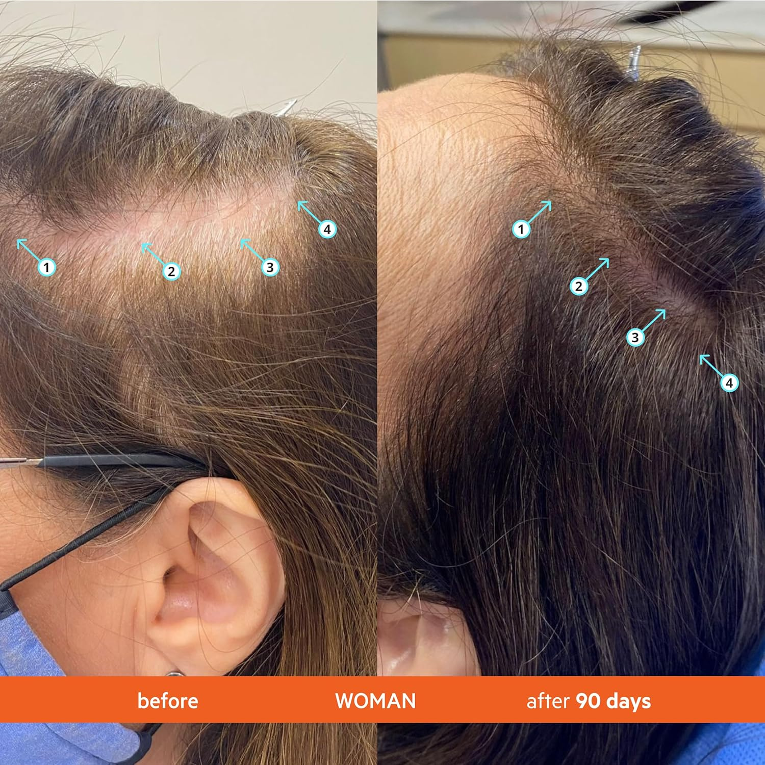 DS Labs Revita Shampoo and Conditioner &ndash; High-Performance Hair Density Kit, Volumizing, Thickening, Fuller, Sulfate & Silicone Free, for Men & Women, 925Ml, Packaging May Vary