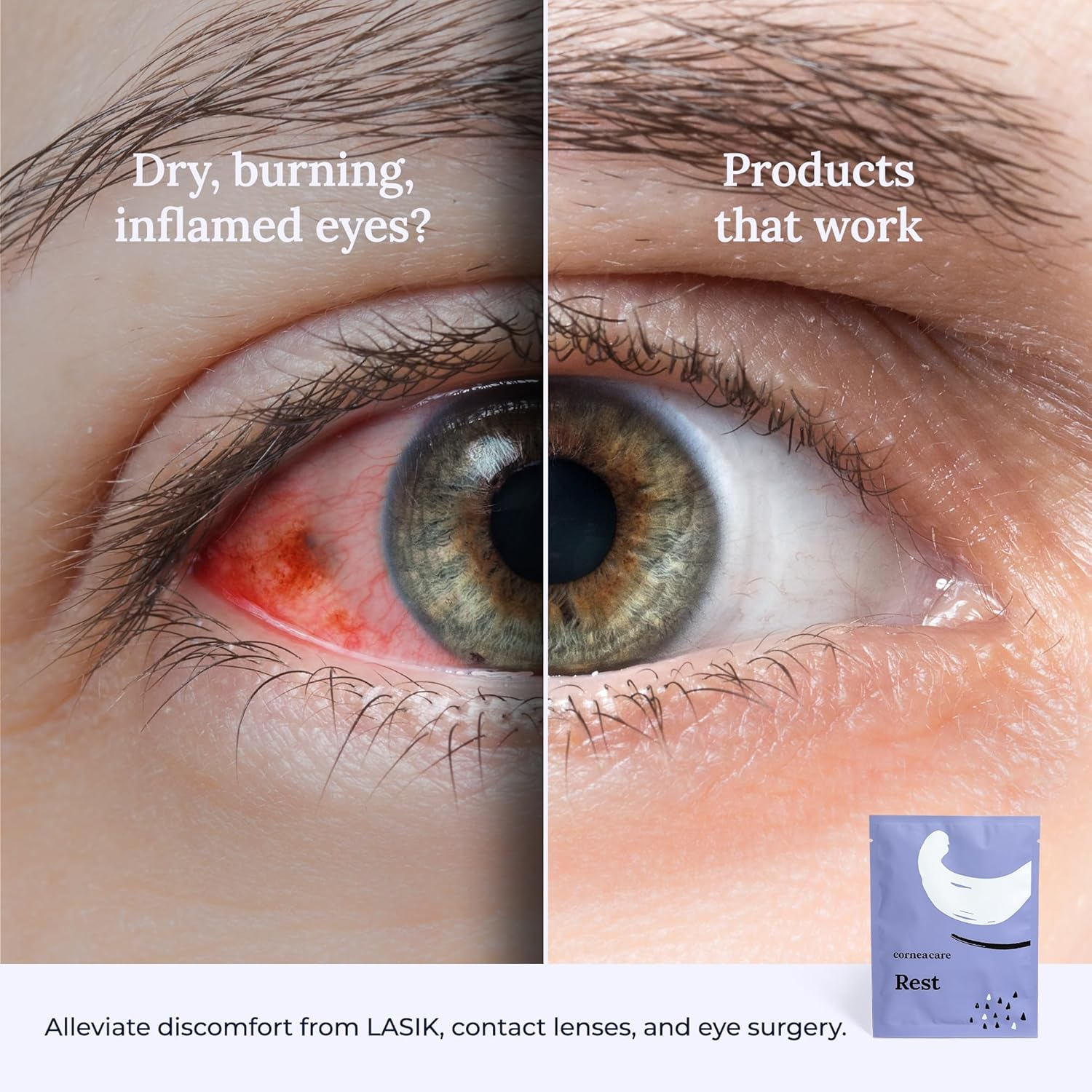 Corneacare Rest: Self Heating Warm Compress for Eyes | Heated Eye Mask for Fast Relief of Dry Eyes | No Microwave Needed | Travel Ready | Eye Treatment Products for Dry Eye Relief | 30 Count image number 1