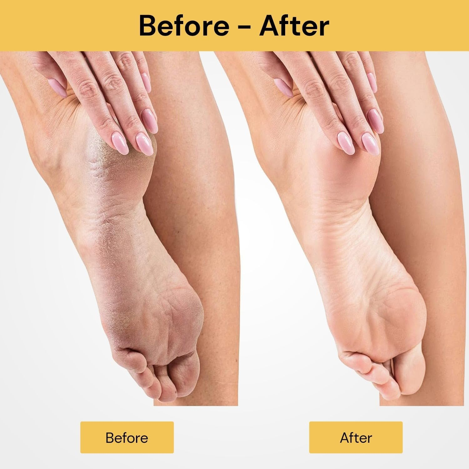 EZONEDEAL Electric Callus Remover Foot File, Rechargeable Pedicure Tools for Dry Hard Cracked Dead Skin on Your Heels & Feet. Spa Quality Exfoliation-Pink image number 5