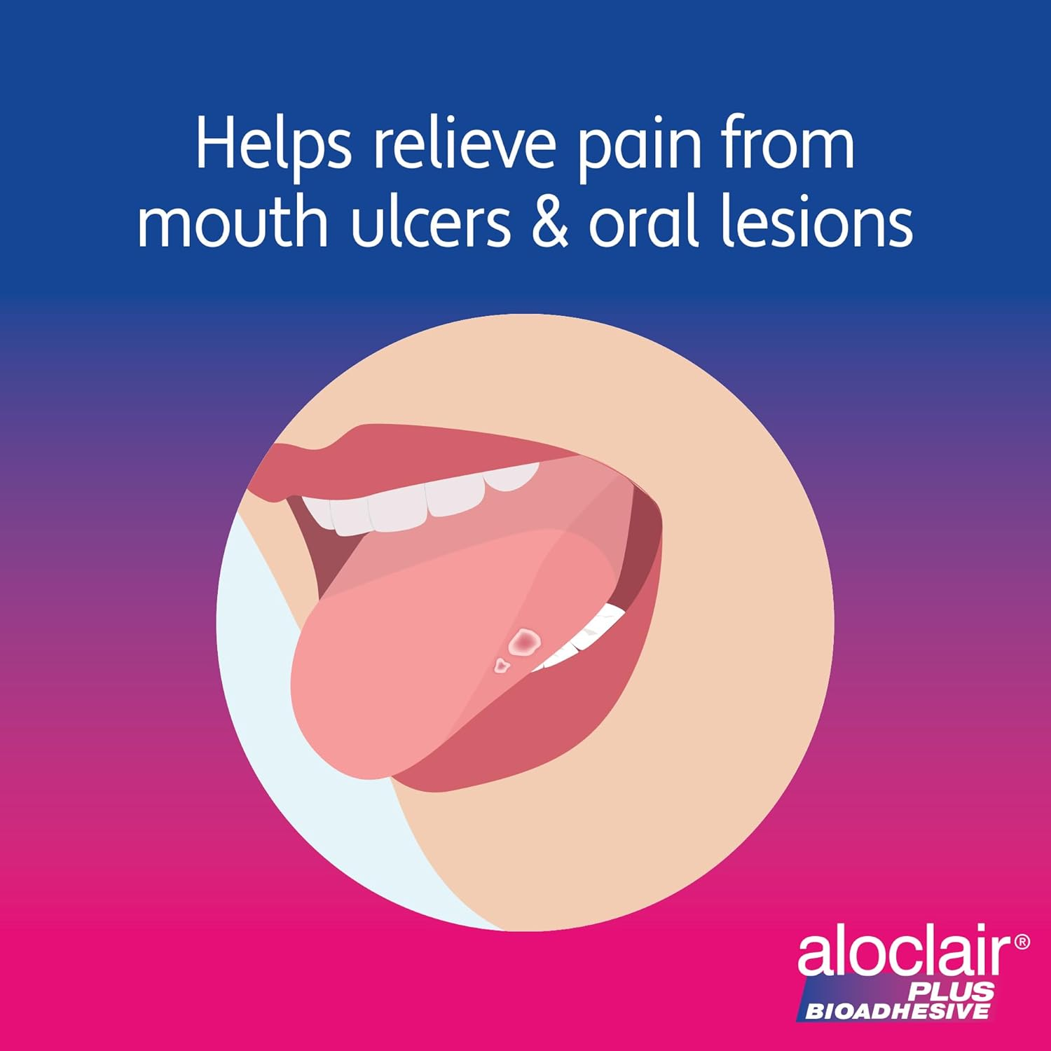 Aloclair 8 Ml Mouth Ulcer Treatment Gel image number 4