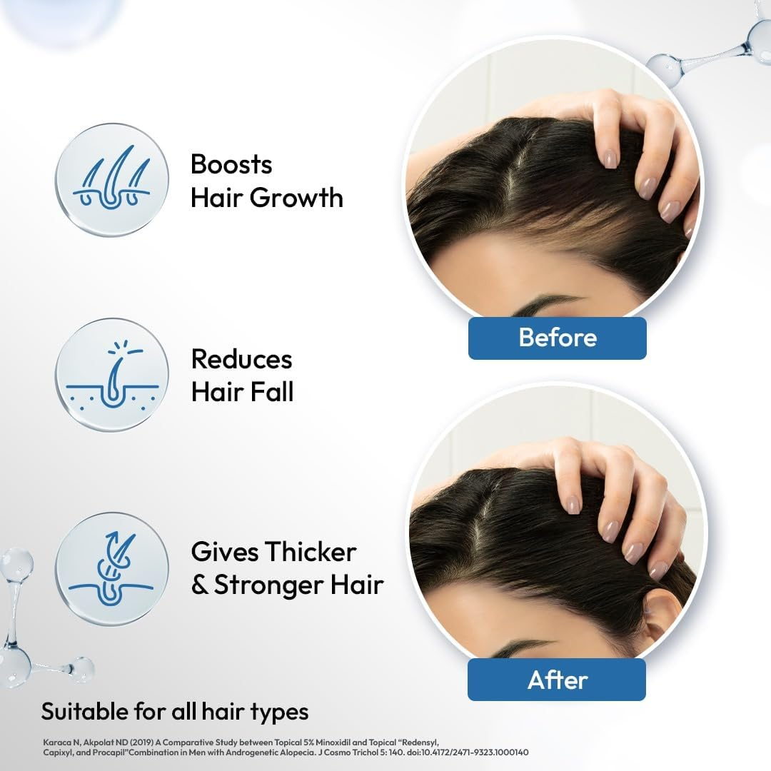 Scalpe Pro Hair Growth Serum with Applicator | 3% Redensyl, 4% Capixyl, 3% Procapil, 3% Anagain | Boosts Hair Growth | Thicker & Stronger Hair | Non-Sticky | Paraben & Sulphate-Free | Unisex | 30 Ml image number 1