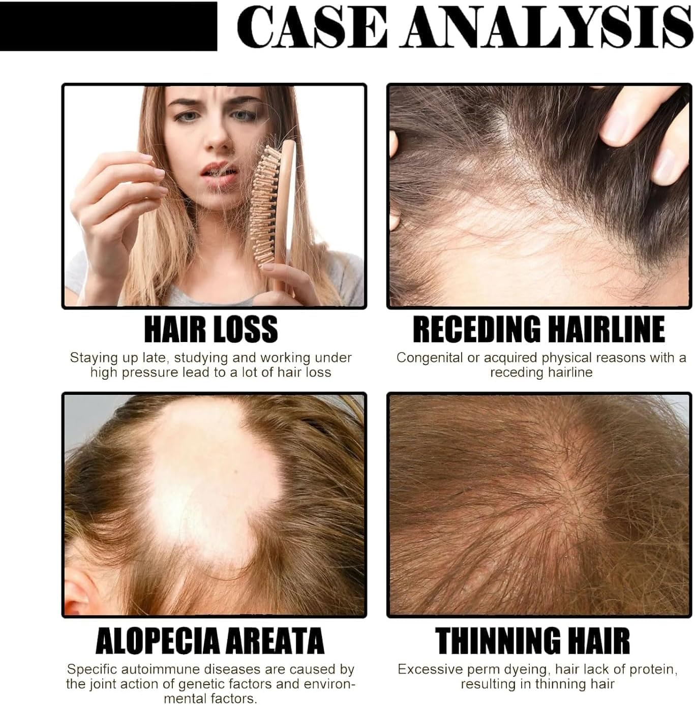 LYSYYAZ Deoxyribose Gel Hair Growth Serum, 60Ml, Unisex-Adults, Clear, Gel Form, for Hair Loss & Thinning, 1 Pcs image number 1