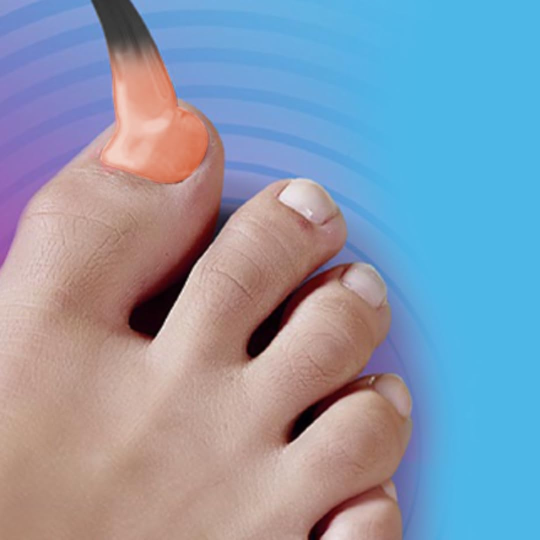 Excilor Ultra Colour - Nude 30Ml. Coloured Nail Fungus Treatment for Infected Nails + a Matching Regular Nail Polish to Match-Up Your Healthy Nails in the Same Colour