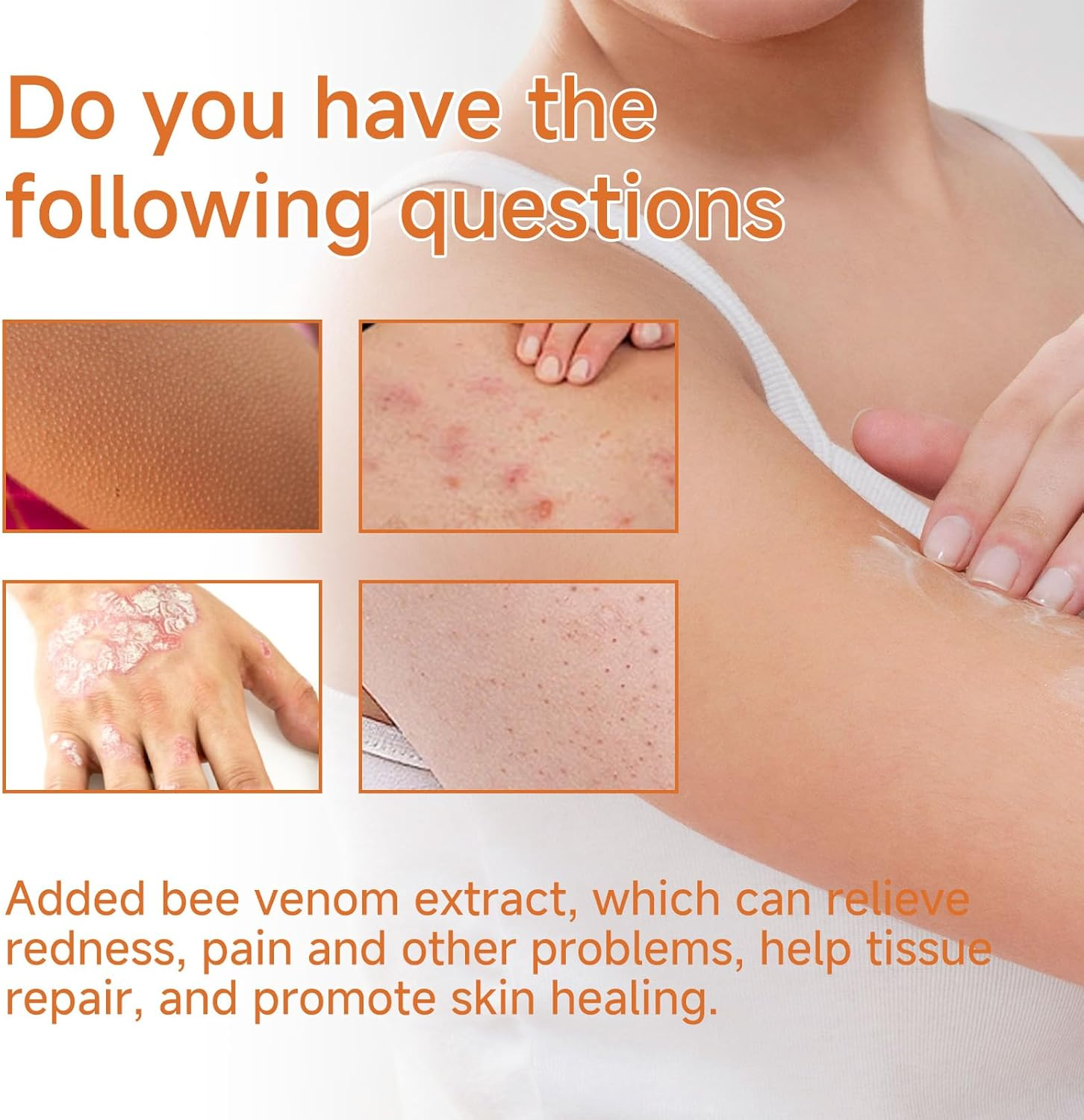 20G Skin Care Cream, Can Relieve Redness, Itching, Relieve and Moisturize Skin Care image number 6