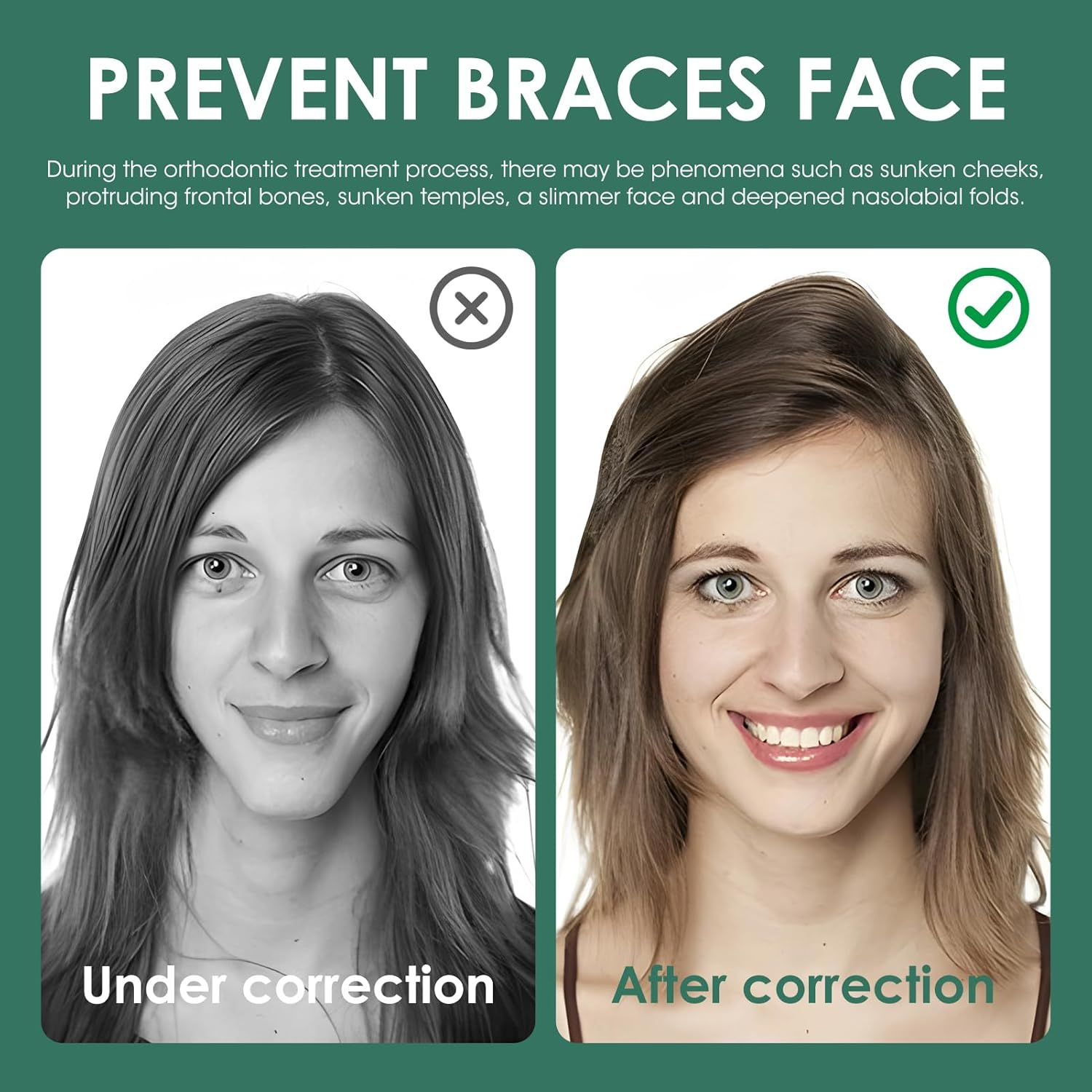 24 Pcs Silicone Orthodontic Chew Stick, Hollow Aligner Tray Seater, Multi Color Aligner Chewies - Aligners Retainers Braces Orthodontic Seating Correction Accessories image number 1