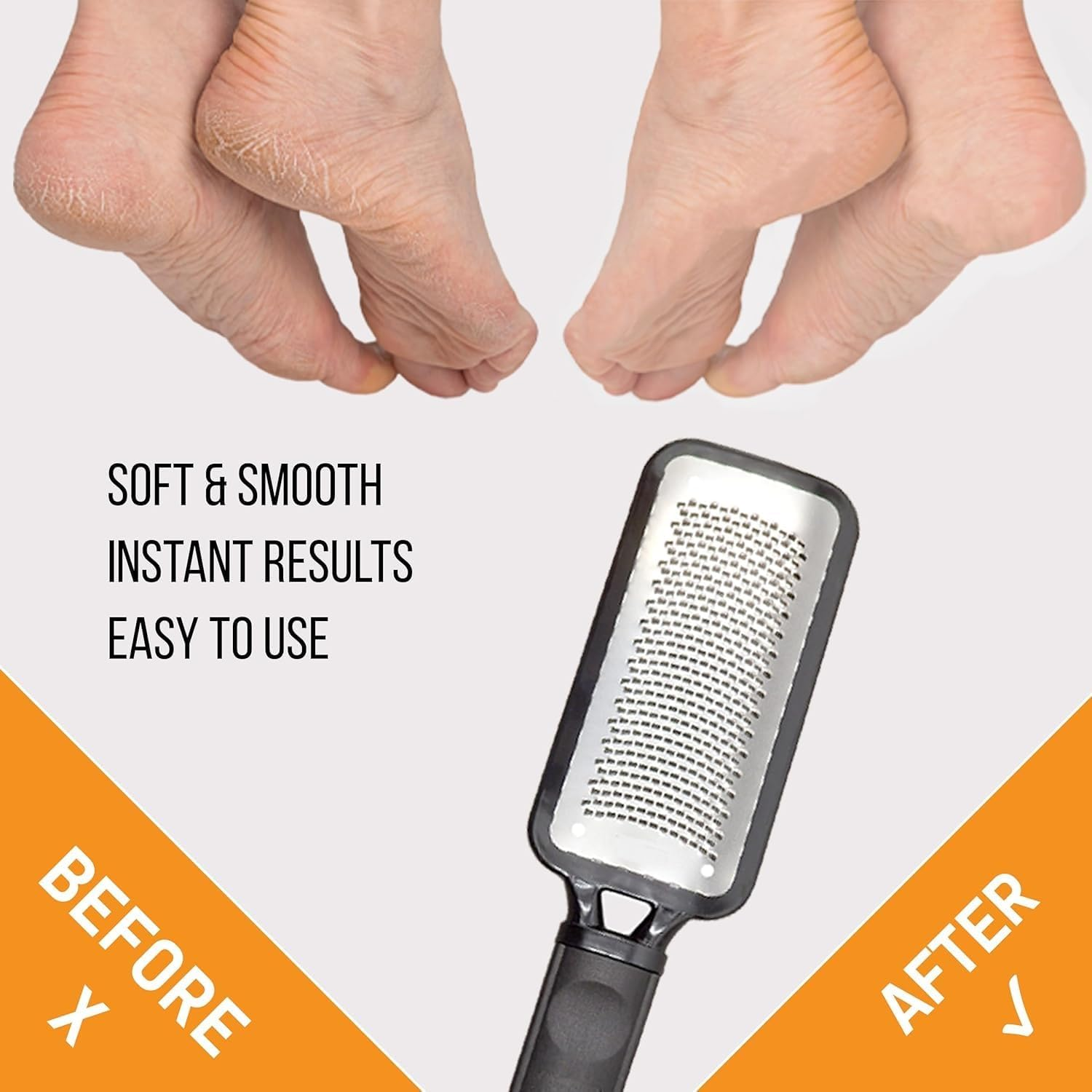 Foot Rasp Foot File and Callus Remover - Pedicure Tool for Removing Dead Skin, Feet Hard Skin Remover, Foot Scraper, Can Be Used on Both Wet and Dry Feet (Black, One Size)