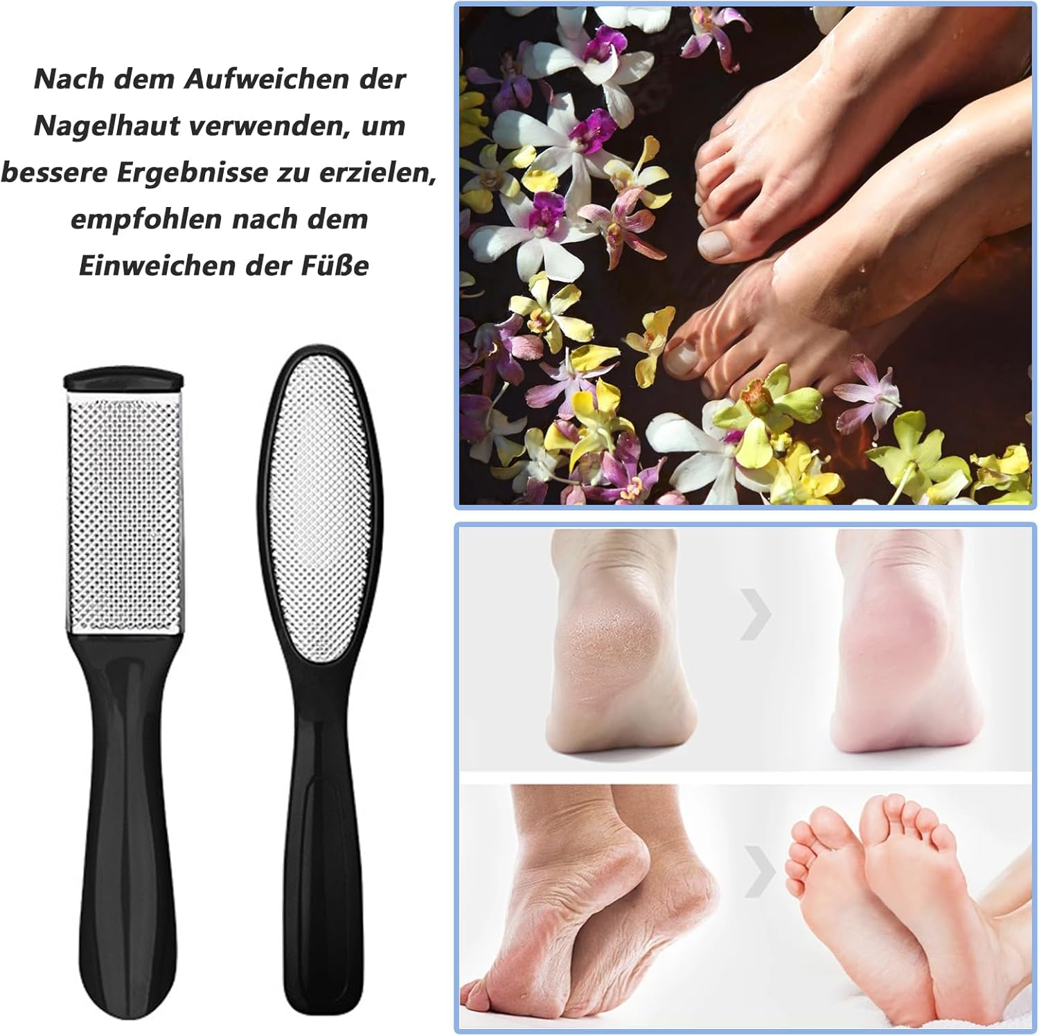 Pack of 6 Callus Removers, Callus Removal Foot, Callus Oble, Rasp, Callus File, Callus File Foot, Double-Sided Stainless Steel Foot File, Callus Rasp, Callus Remover image number 1