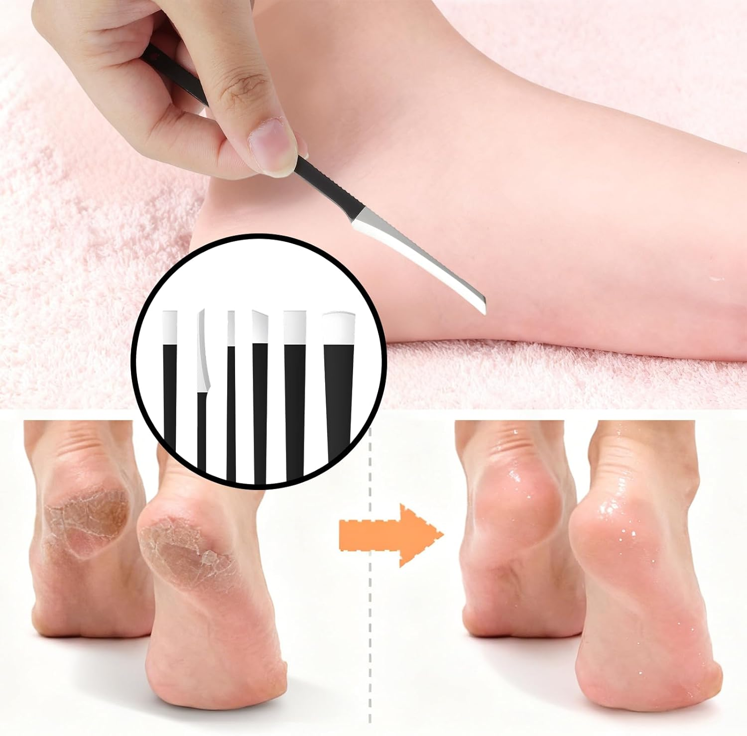 Stainless Steel Pedicure Set 6-Piece Professional Ingrown Toenails Set with Callus Obe, Pedicure Knife, Nail Lifter, Foot Care Set with Storage Box for Home, Travel Podiatry Instruments