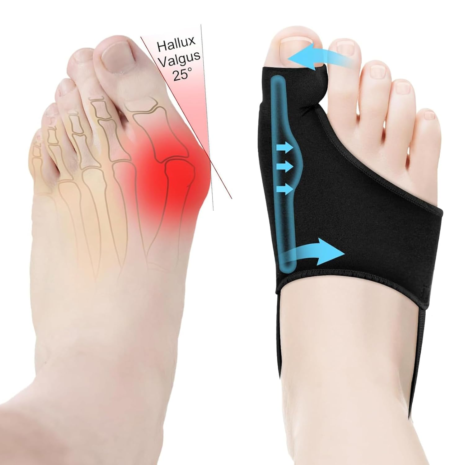 2-Pack Bunion Corrector for Women & Men &ndash; Adjustable Toe Straightener with Breathable Cushion, Hallux Valgus Support Splint for Day/Night Wear image number 4