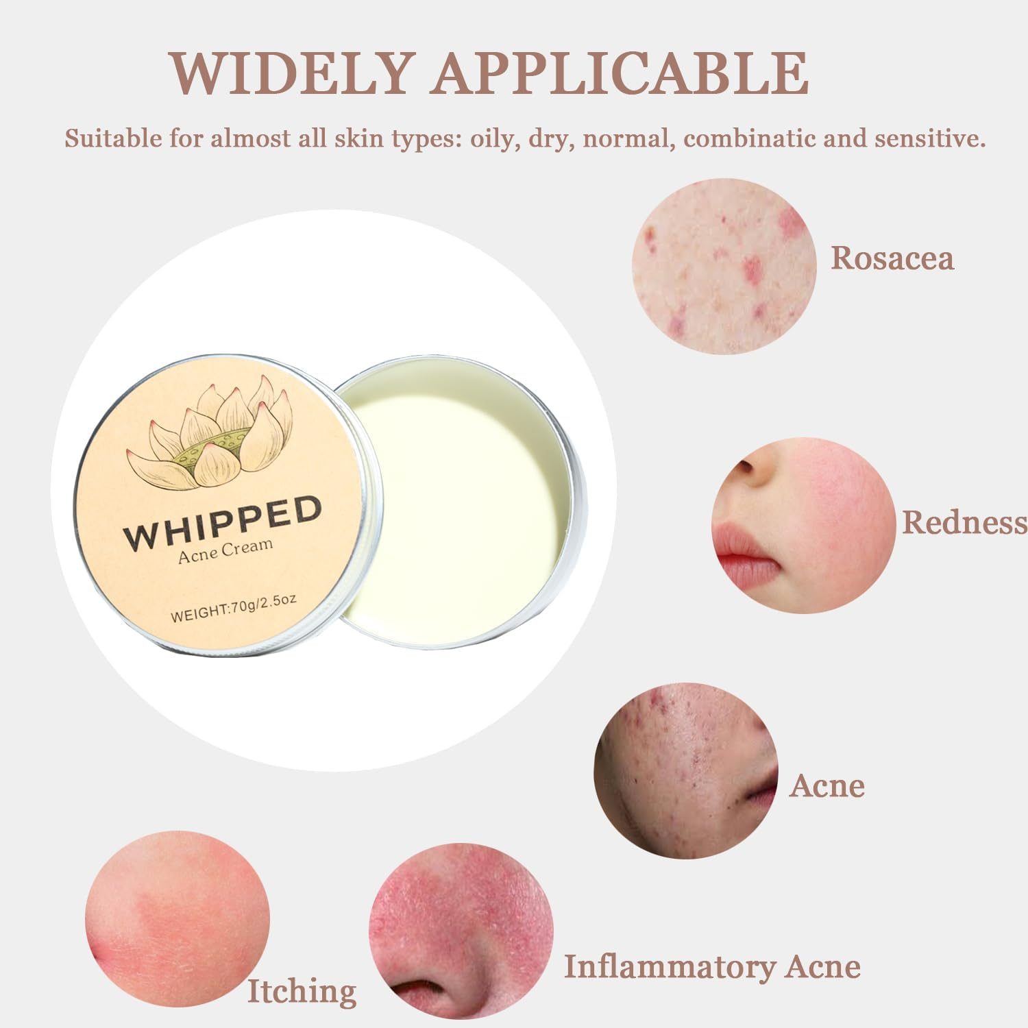 Norse Organics Acne, Norse Organic Acne and Redness Relief Balm, Norse Organics Acne & Redness Killer, Acne Remove Skin Care Set, Face Balm for Teens and Adults(70G/2.5Oz) image number 6