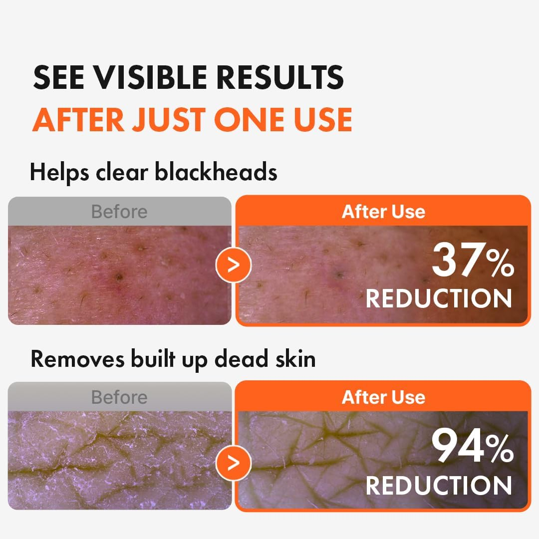 (AHA - for Dry Skin) - Hanskin Cleansing Oil Cleanser Blackhead Facial AHA Moisturiser Dry Skin Nature Organic (10.14 Fl.O.Z) (A Free Sample) (THANKYOU LABEL) (AHA - for Dry Skin) image number 1