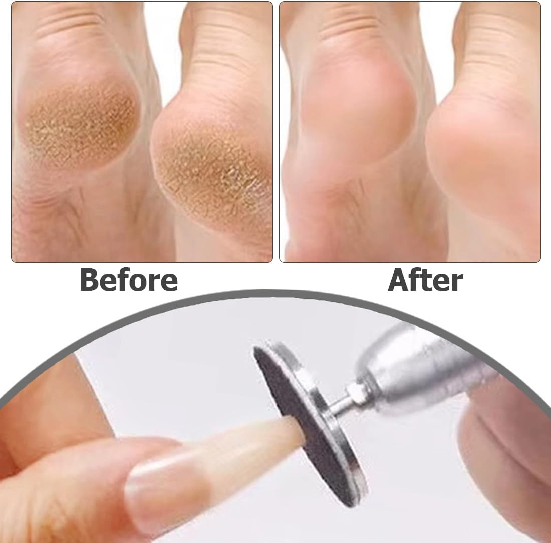 Weddhuis Pack of 60 Sanding Discs Pedicure Nail Sanding Discs with Metal Nail Drills 25 Mm Replacement Foot Nail Cutter Attachments Bits for Electric Callus Accessories with Storage Box (80#120#180#) image number 5