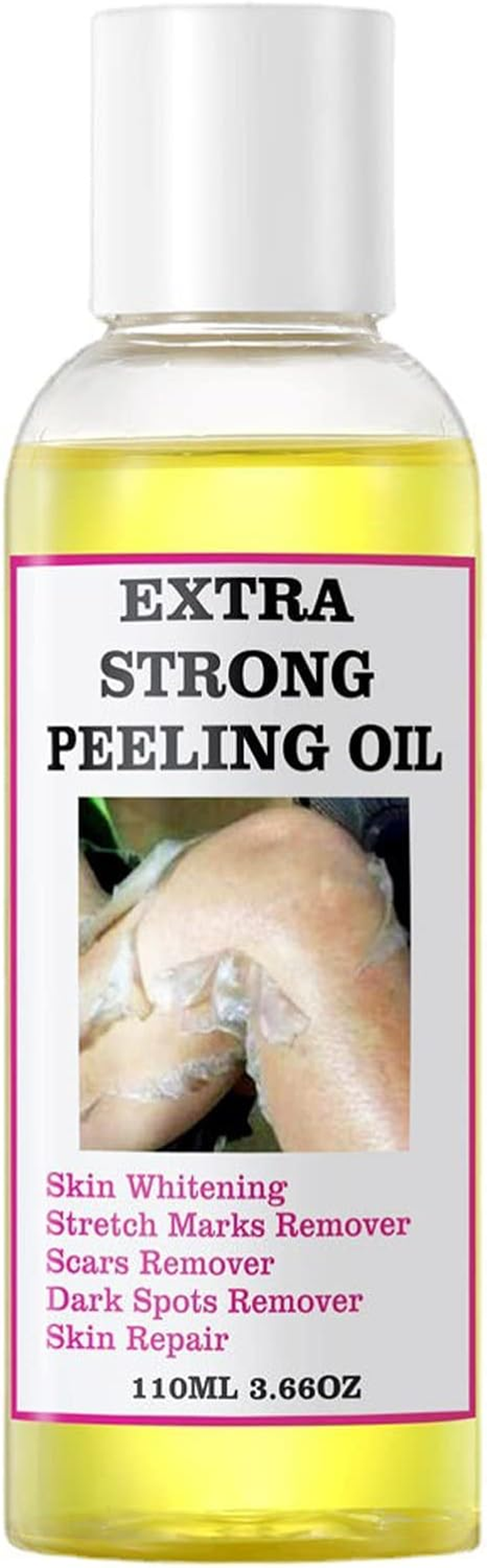 2 Skin Peeling Exfoliator | 110Ml Portable Effective Yellow Peeling Oil, Skin Peeling Solution Multi-Use Spot Correcting and Brightening Oil for Elbows, Knees, Fingers Puchen