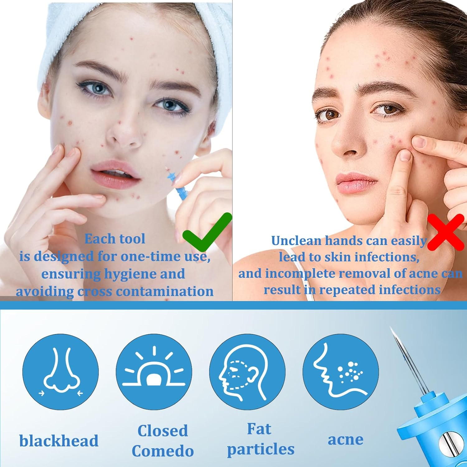 100 Pieces Blackhead Remover Tool, 2 Boxes Pimple Popper Kit, Skin Care Tools for Blackhead and Pimple Removal, Skin Control and Care Essentials image number 2