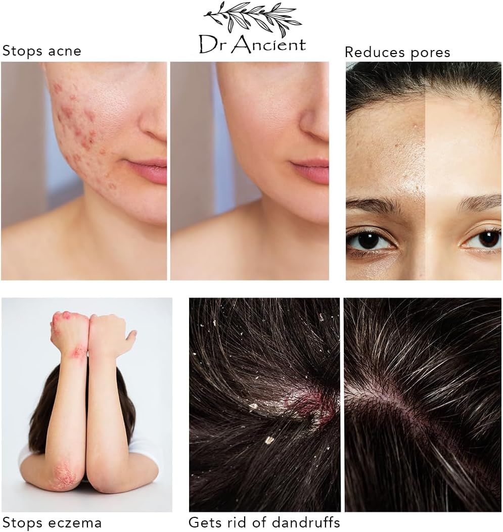 Dr.Ancient Sulphur Soap Bar Organic Natural Vegan Traditional Handmade Antique - Antibacterial, Effective for Acne - Absolutely No Chemicals! Pure Natural Soap! image number 5