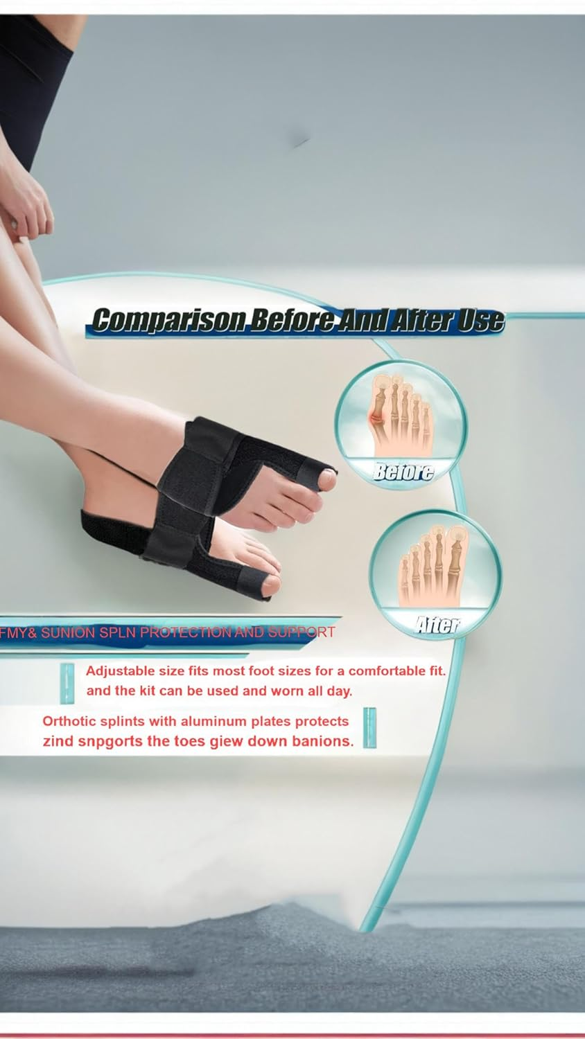 Honwor Bunion Corrector & Toe Straightener - Adjustable Orthopedic Splint for Hallux Valgus & Pain Relief - Fits Both Feet image number 1