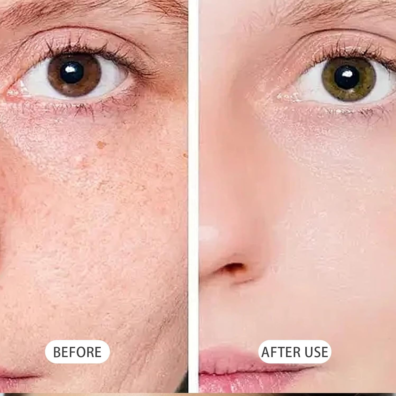 Hypochlorous Acid Face and Skin Spray,Safe for Use on Acne Prone Skin, Dry Scalp, Toner, Eye Lash Cleanser, Face and Hand Cleanser - 100Ml image number 3