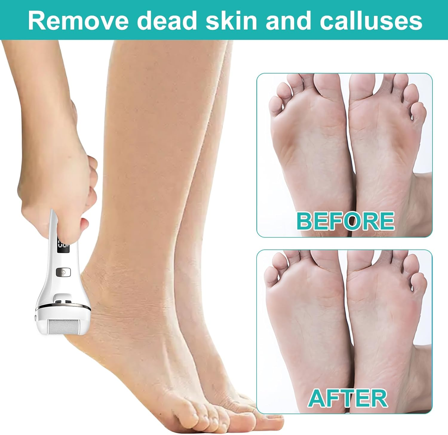 3 Replacement Rollers Callus Remover Electric 3 Types of Rough for Callus Corn Removal, Foot Care Equipment Accessories for Pedicure Foot Care Set image number 6