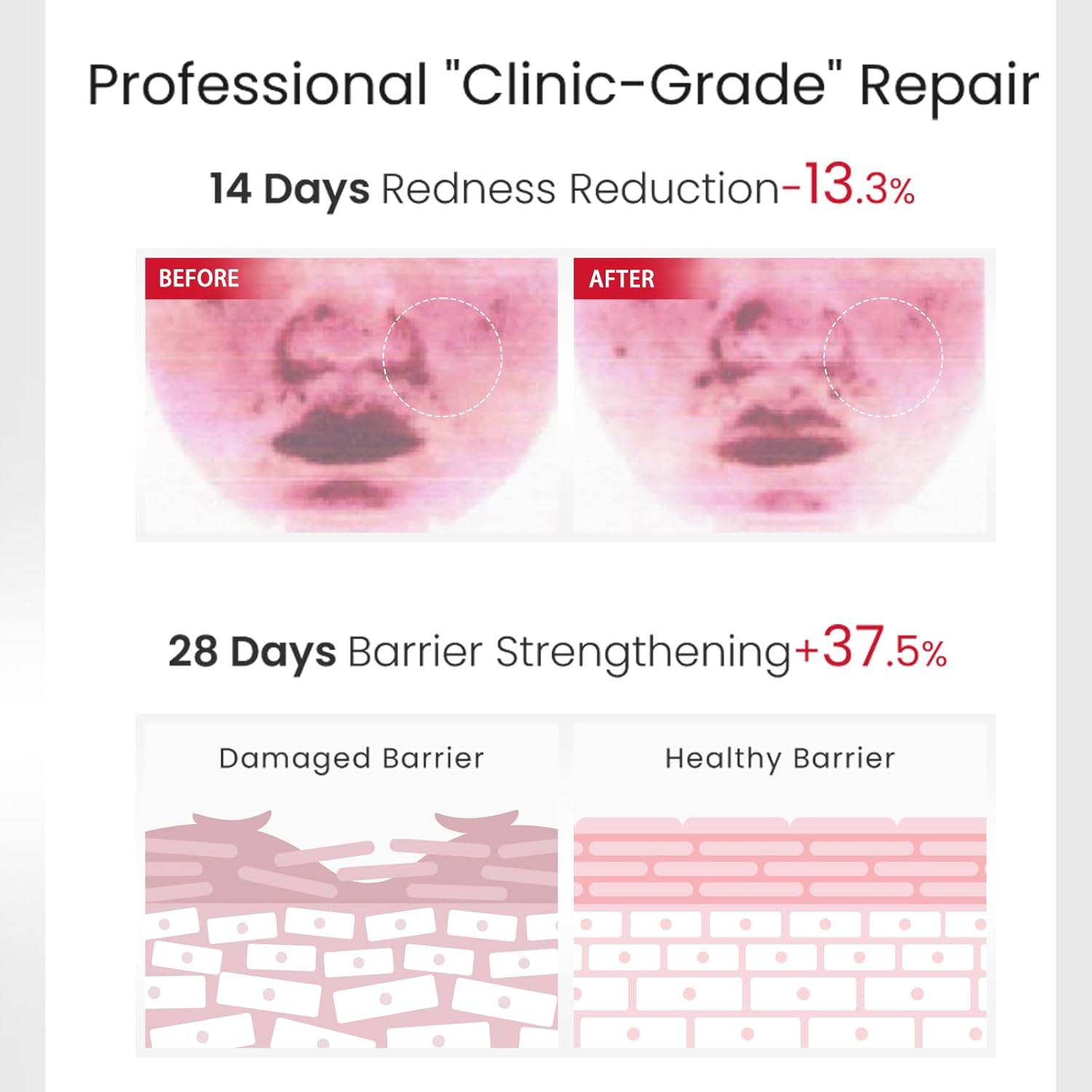 Winona Face Serum 1.5Ml&times;30, Barrier Repairing Essence for Sensitive & Fragile Skin, Single-Dose BFS Ampoule Design, Portable, Hydrating Repair Essence, Boosts Collagen & Strengthens Skin Barrier image number 4