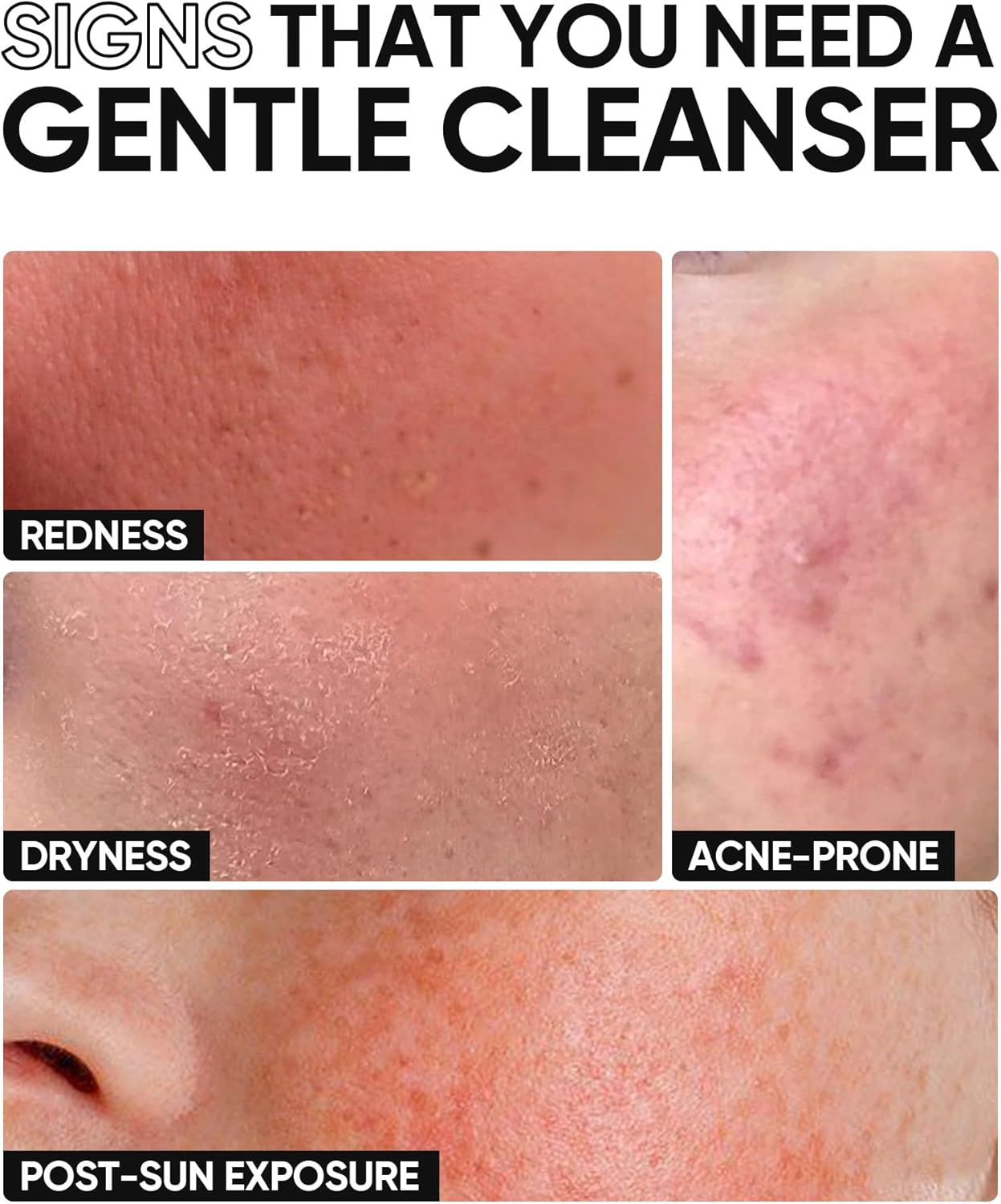 Skintific 5X Ceramide Low Ph Cleanser with Amino Acids, Hyaluronic Acid for Sensitive Skin, 80Ml, Hydrating Face Wash image number 6