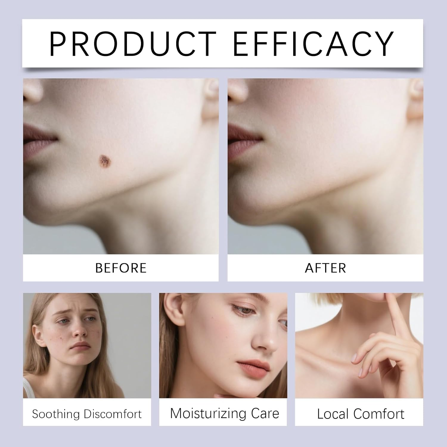 Chillerase Bump Renewal Spray, Advanced Salicylic Acid Body Spray, Natural Skin Spray, Effectively Reduces Skin Imperfections, Moisturizing and Soothing, Suitable for Face and Body (2Pcs) - 2Pcs image number 2