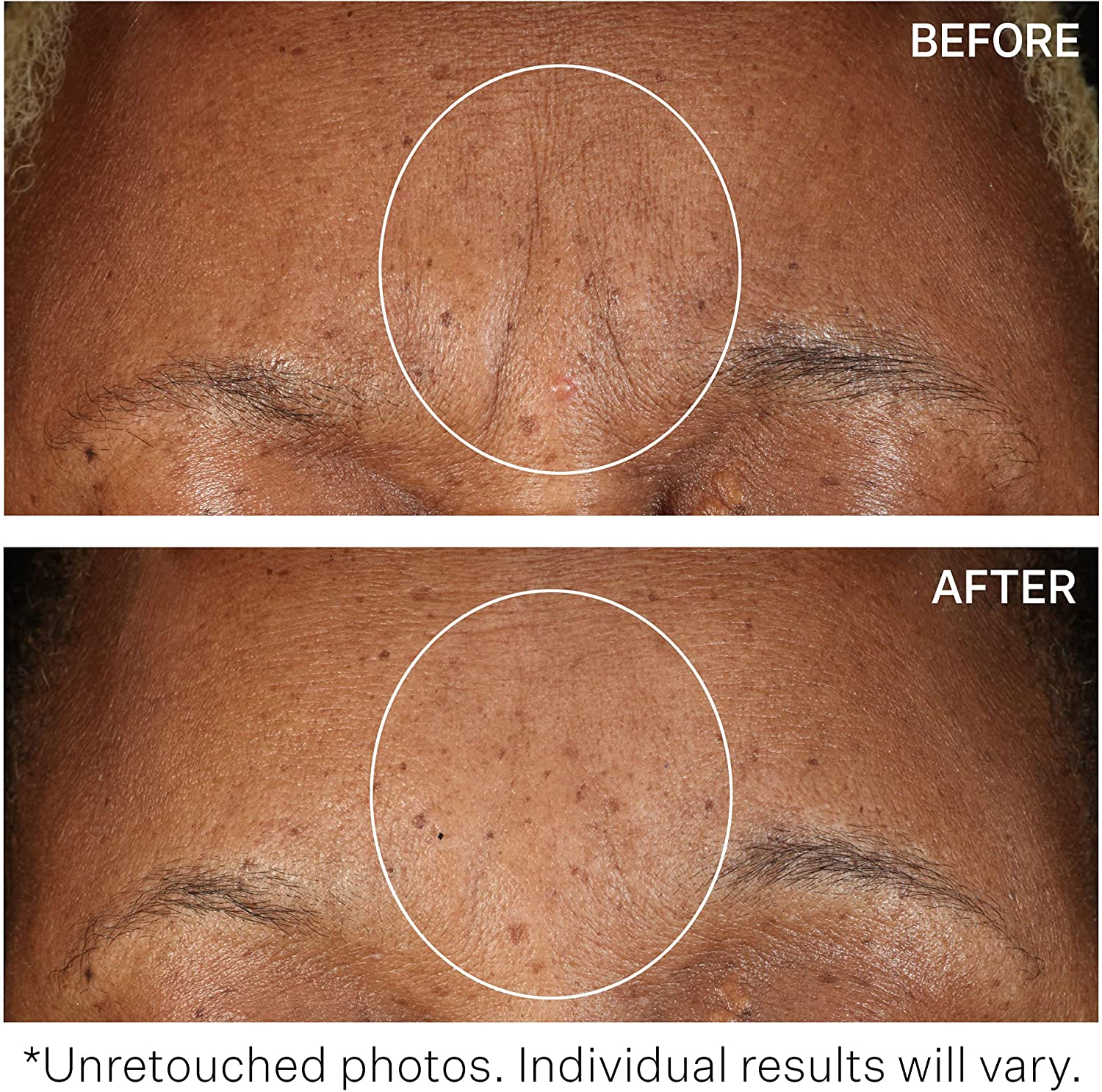 Strivectin Strivectin SD Advanced plus Intensive Moisturizing Concentrate for Unisex 4 Oz Moisturizer, 118 Ml image number 1