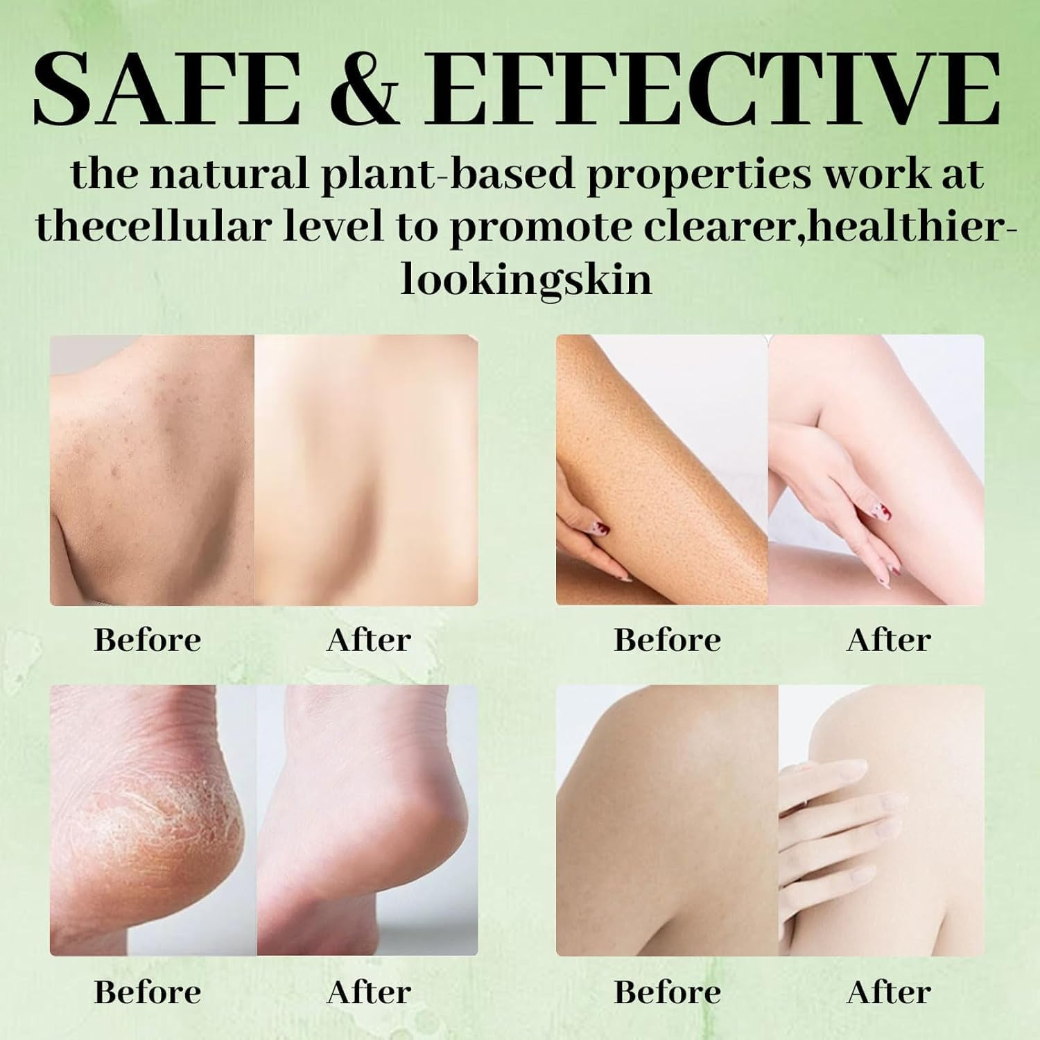 Loravey Tea Tree Relief Soap Bar, Tea Tree Oil Soap Bar, Green Soaps, Natural Foot & Body Soaps for Healthy Skin, All Natural Skin Cleanser, for Men & Women (3PC)