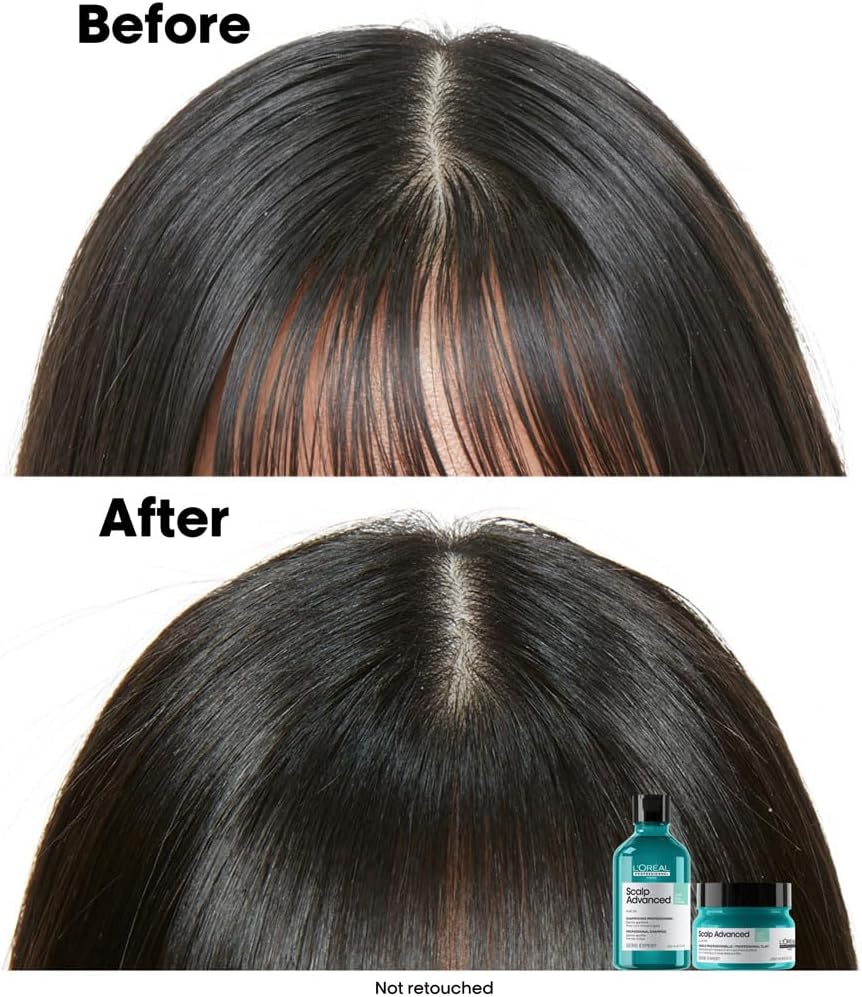 L&rsquo;Oreal Professionnel Serie Expert Scalp Advanced Anti-Oiliness 2-In-1 Clay 250 Ml image number 6