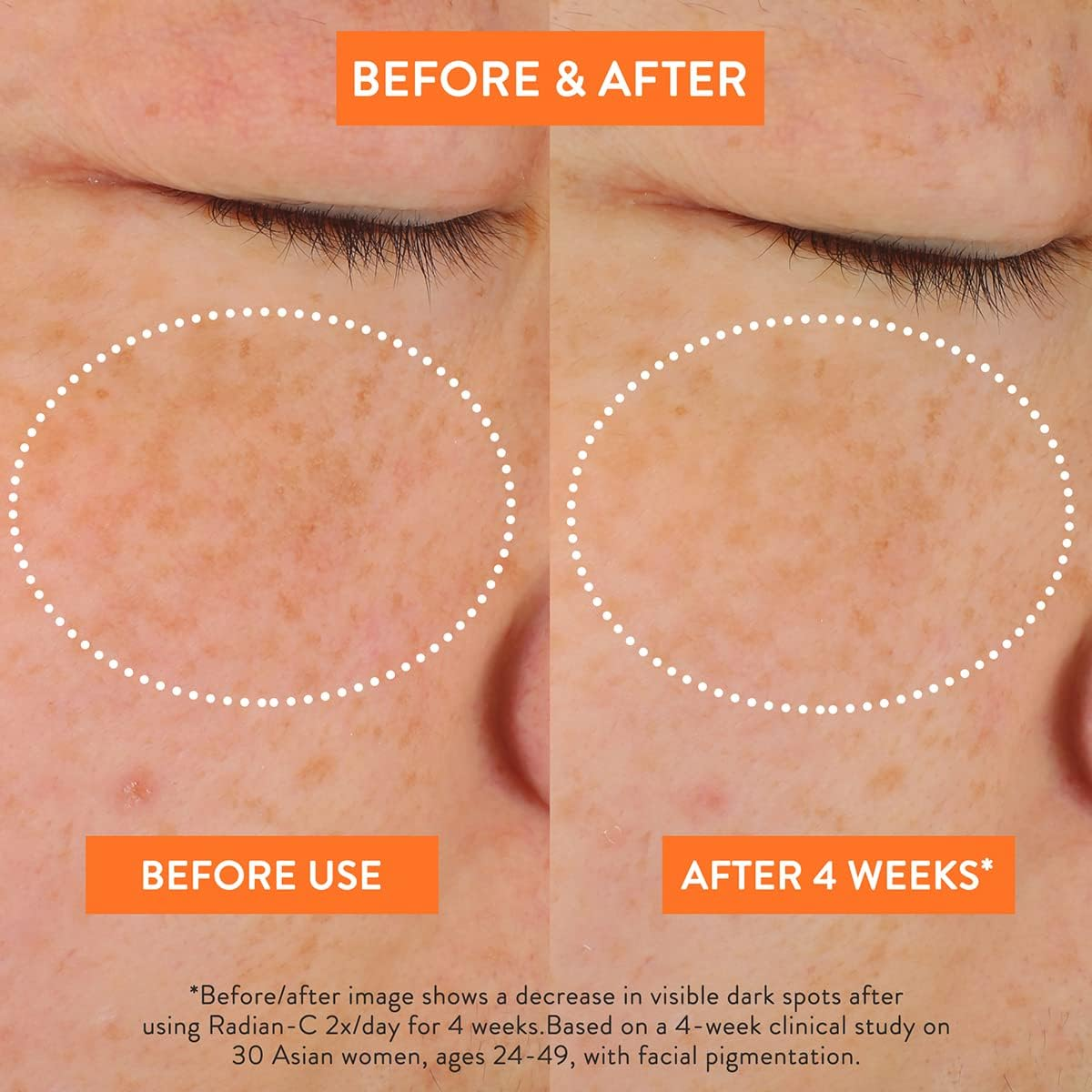 LANEIGE Radian-C Cream: Brightening Moisturizer with Vitamin C & E for Dark Spots, Dullness, & Radiant Skin, Hypoallergenic & Dermatologist-Tested image number 5