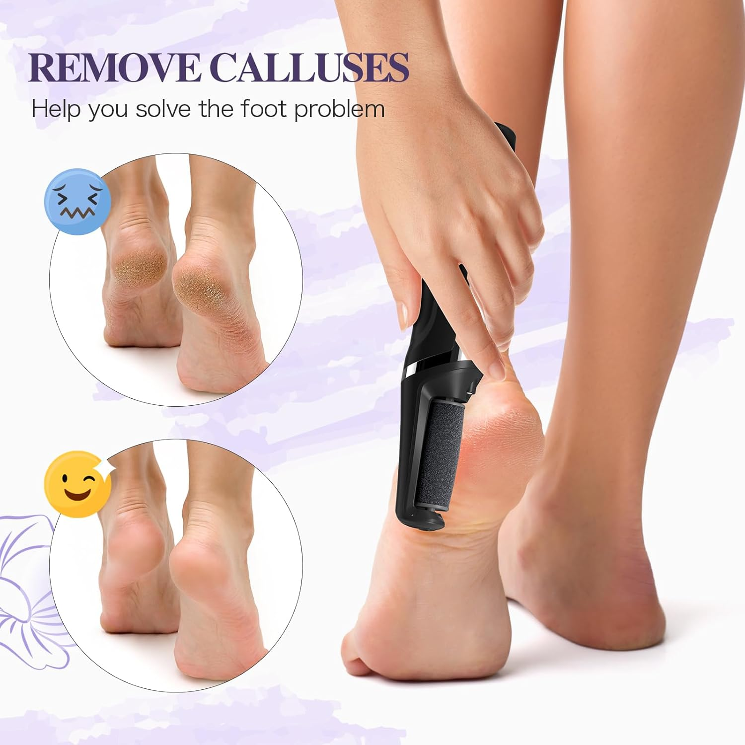 Electric Foot Callus Remover, Smooth Pedicure Wand Feet Rechargeable, Electric Foot File Pedicure Tool with 3 Rollers, 3 Speeds for Dry Cracked Heels, Hard Skin, Calluses, Dead Skin (Black) image number 6