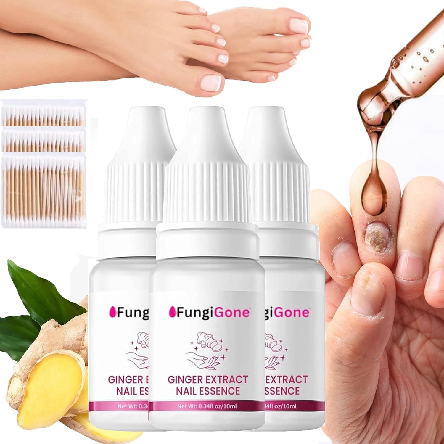 Fungigone Nail Treatment, Fungigone Nail Fungus Removal, 7 Days Nail Fungus Treatment for Toenail, Foot F-Ungus Treatments Nails Care Solution for Toenails & Fingernails (3 PC)