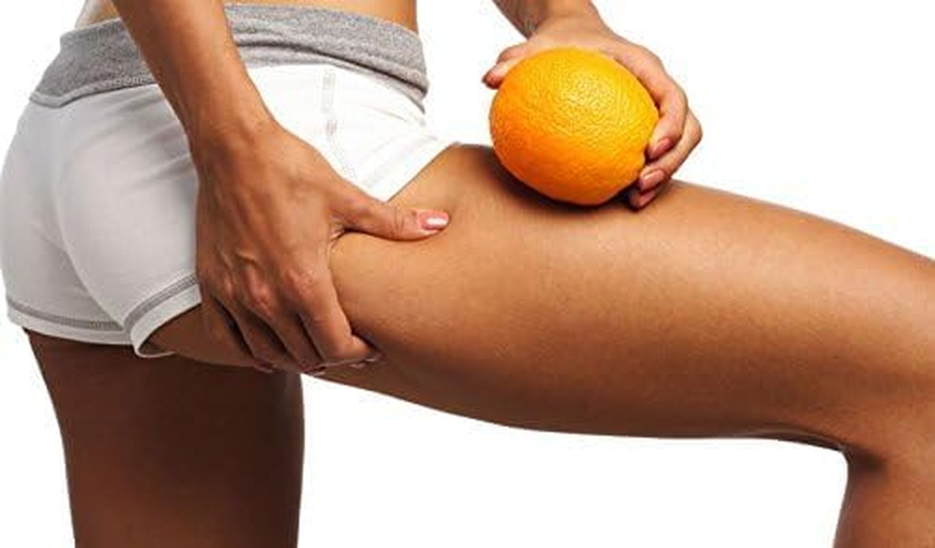 TESMED Cell anti Cellulite Massage Roller with Handle - Green image number 1