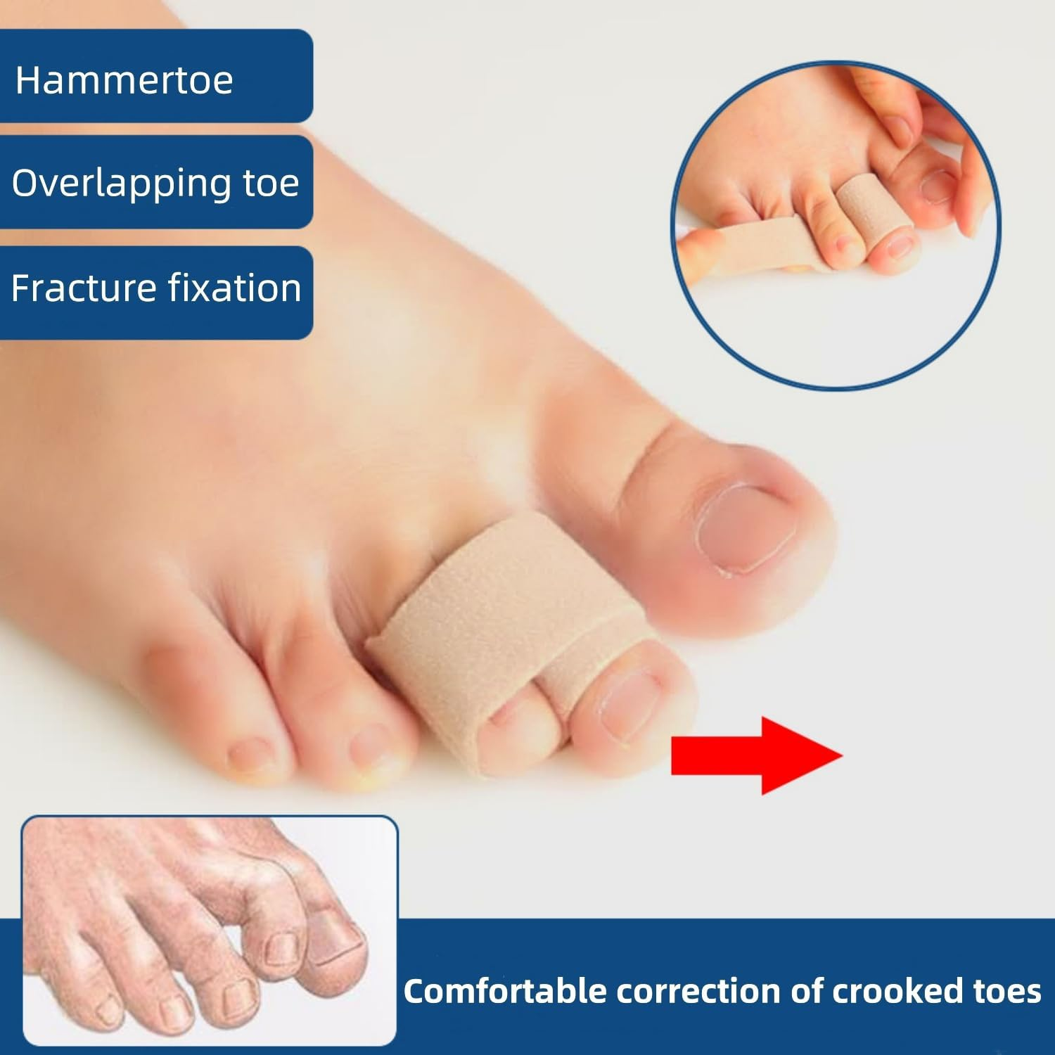 Fabric Hammer Toe Corrector, 10 Pack Toe Splints, Toe Corrector, Toe Wraps for Curled Toes, Crooked Toes and Hammer Toes image number 2