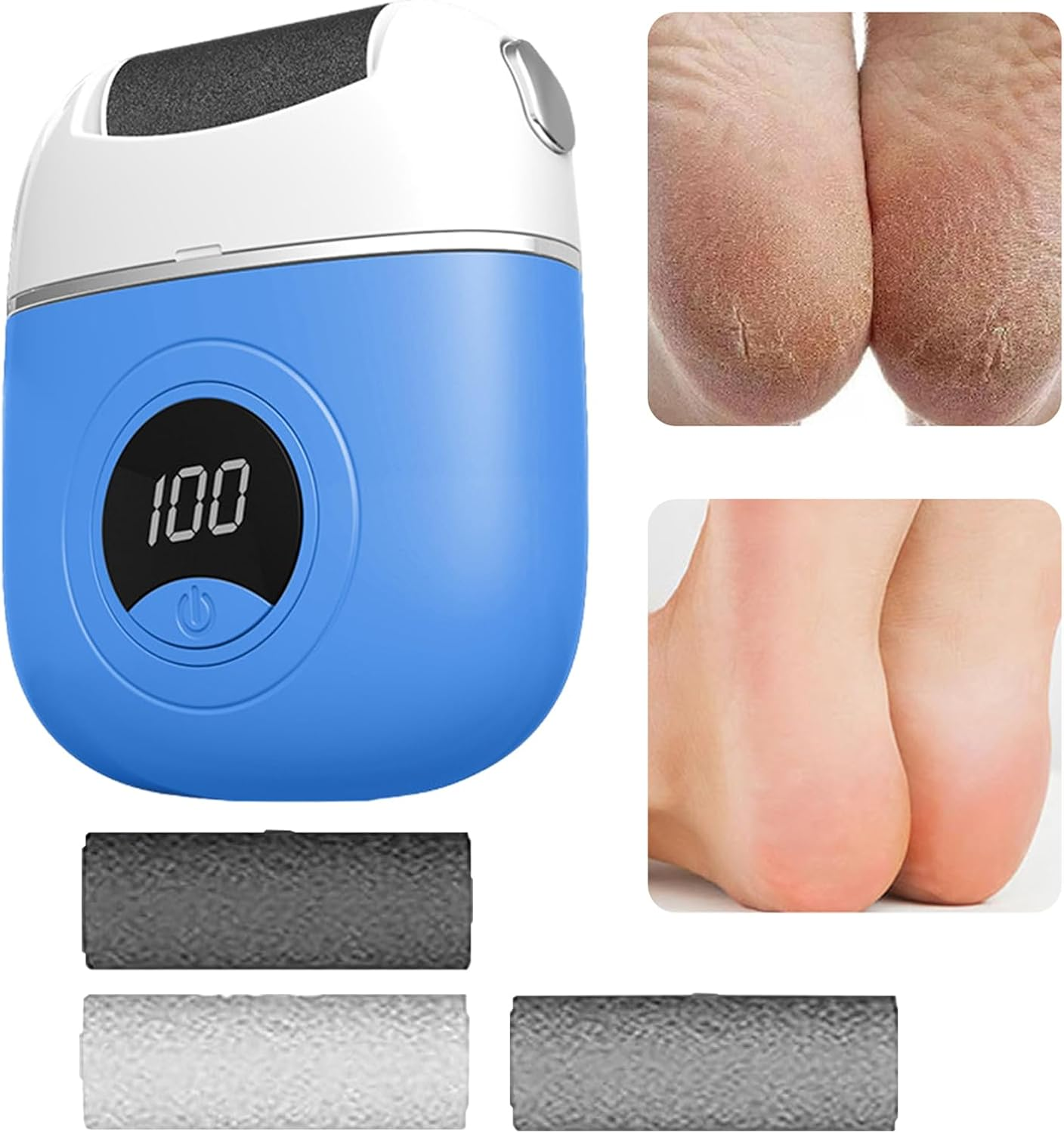 Electric Foot File, Callus Remover, Powerful Pedicure Grinder, Adorable Foot Care Tool, Rechargeable Scrubber Roller for Smooth Feet and Dead Skin Removal, Orange, Blue, Gray