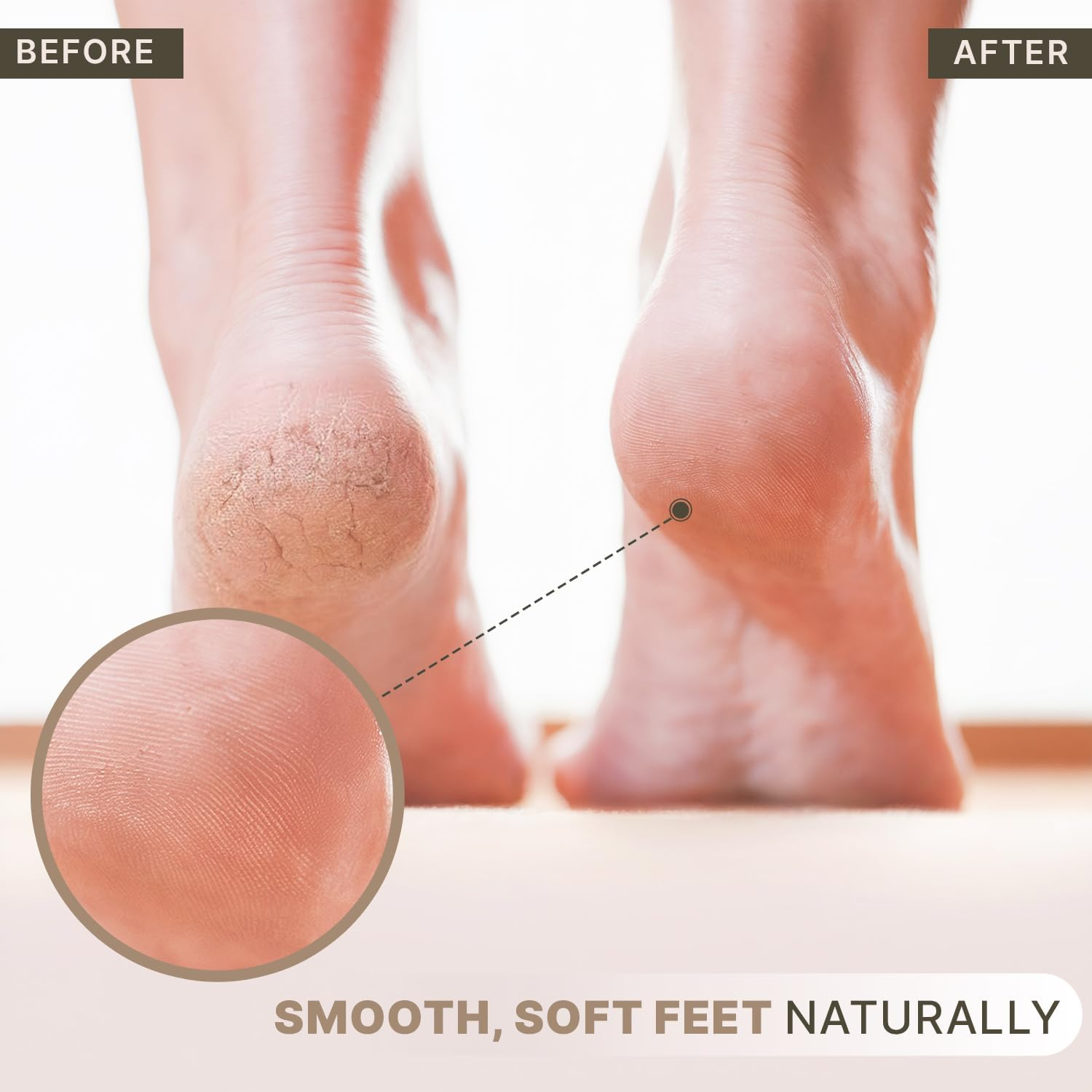 Beauty by Earth Natural Lava Exfoliating Pumice Stone; Callus Removal for Hands & Rough Feet plus Dry, Dead, Hard or Cracked Heels; for Pedicures to Repair & Restore Soft, for Men or Women image number 3