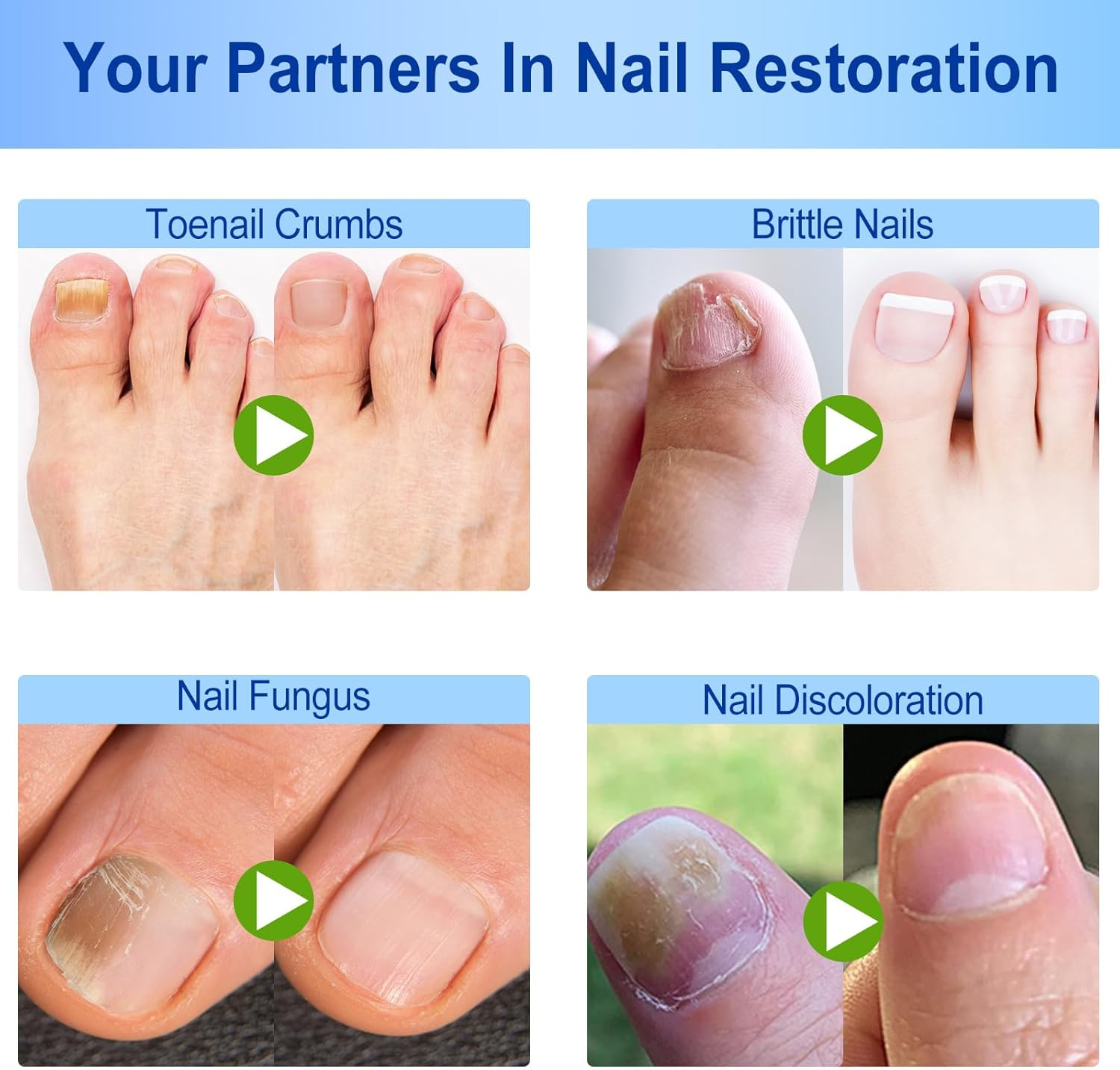 Fungal Nail Treatment,Nail Repair Patches 60Pcs,Toe Nail Treatment,Nail Repair Treatment for Restores Damaged Nails, 8 Hour Overnight Nail Repair Restores Healthy Nails image number 3