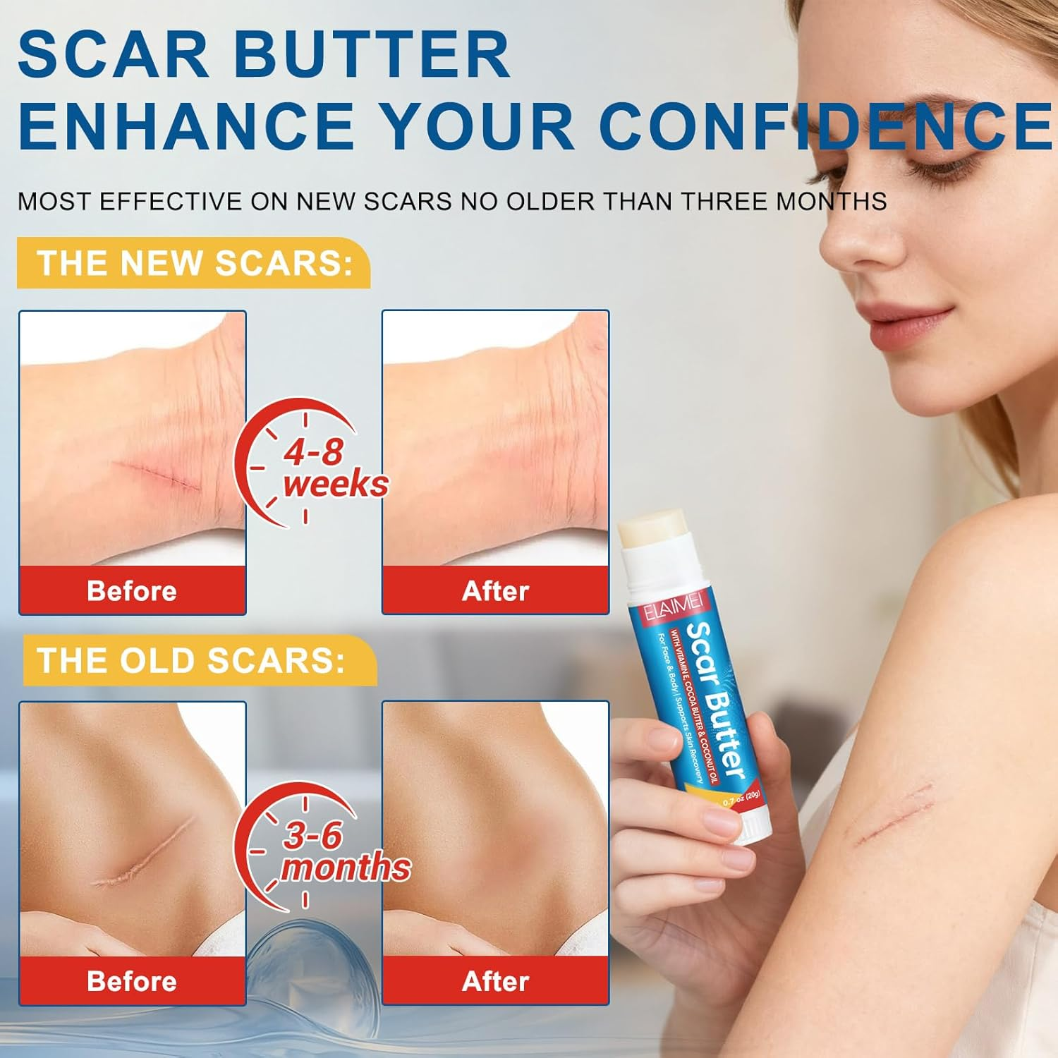 Scar Butter Stick 20G | with Vitamin E, Cocoa Butter & Coconut Oil | Moisturizing Balm for Face & Body | Helps Support Smooth & Nourished Skin image number 1
