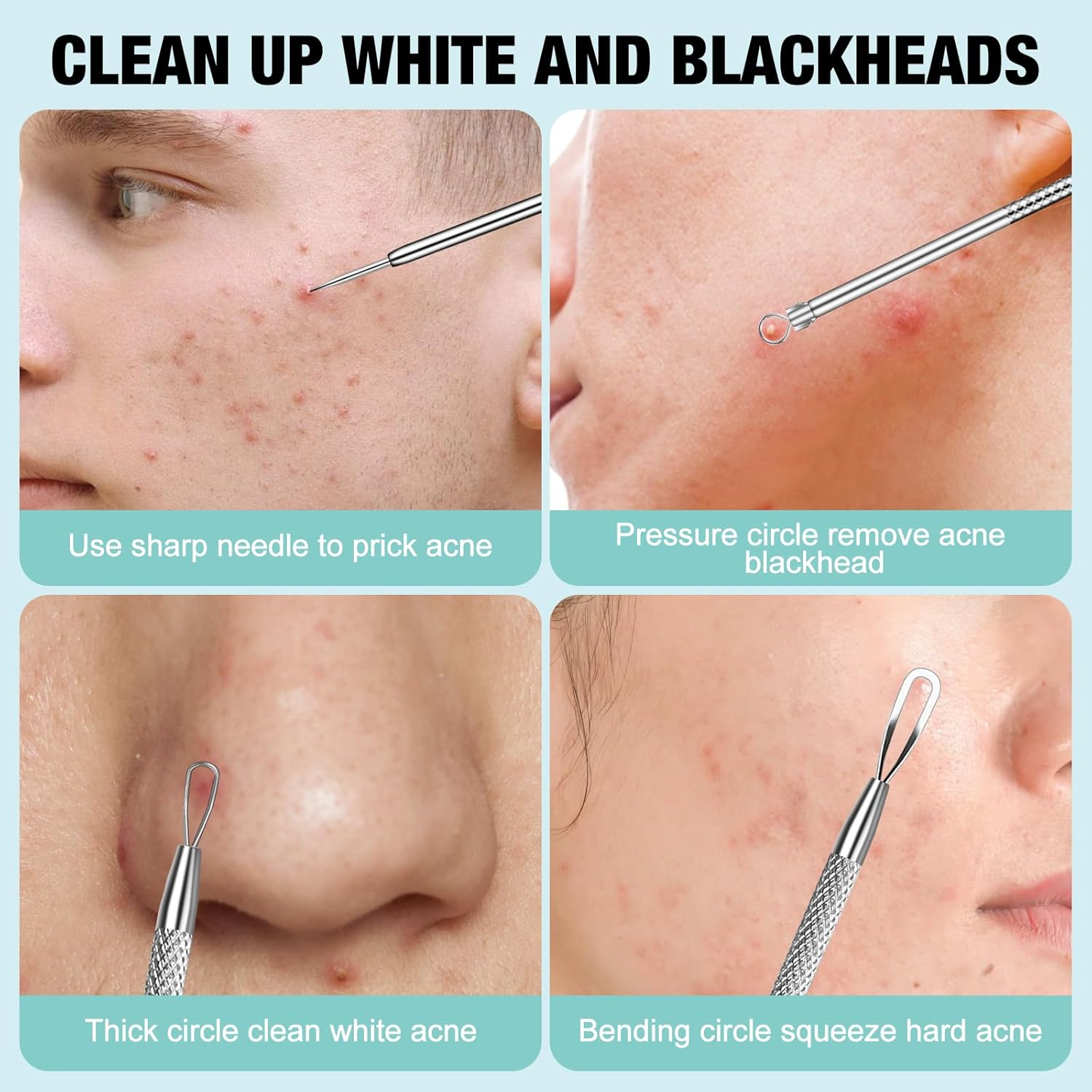 MUIIGOOD 3Pcs Blackhead Remover Pimple Popper Tool Kit Pimple Extractor Acne Treatment Surgical Grade Blackhead Comedone Removal Popper Tool Cleaning Brush for Face Nose Lips image number 1